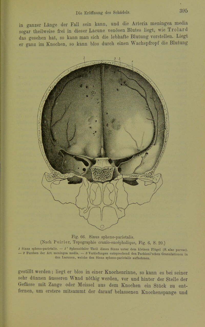 in ganzer Länge der Fall sein kann, und die Arteria meningea media sogar theilweise frei in dieser Lacune venösen Blutes liegt, wie Trolard das gesehen hat, so kann man sich die lebhafte Blutung vorstellen. Liegt er ganz im Knochen, so kann blos durch einen Wachspfropf die Blutung Fig. 66. Sinus spheno-parietalis. (Nach PGirier, Topographie cranio-encephalique, Fig. 6, S. 20.) 1 Sinus spheno-parietalis. — 1' Sphenoidaler Theil dieses Sinus unter dem Meinen Flügel (S. alae parvae). — 2 Furchen der Art. meningea media. — 3 Vertiefungen entsprechend den Pachioni'schen Granulationen in den Lacunen, welche den Sinus spheno-parietalis aufnehmen. gestillt werden; liegt er blos in einer Knochenrinne, so kann es bei seiner sehr dünnen äusseren W^ind nöthig werden, vor und hinter der Stelle der Gefässe mit Zange oder Meissel aus dem Knochen ein Stück zu ent- fernen, um erstere mitsammt der darauf belassenen Knochenspange und