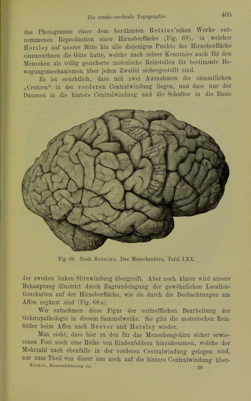 das Photogramm einer dem berühmten Ketzins'sehen Werke ent- nommenen Reproduction einer Hirnoberfläche (Fig. 68), in welcher Horsley auf unsere Bitte hin alle diejenigen Punkte der Hirnoberfläche einzuzeichnen die Güte hatte, welche nach seiner Kenntniss auch für den Menschen als völlig gesicherte motorische Reizstellen für bestimmte Be- wegungsmechanismen über jeden Zweifel sichergestellt sind. Es ist ersichtlich, dass mit zwei Ausnahmen die sämmtlichen „Centren in der vorderen Centralwindung liegen, und dass nur der Daumen in die hintere Centraiwindung und die Schulter in die Basis Fig. 68. Nach Retzius, Das Menschenhirn, Tafel LXX. der zweiten linken Stirnwindung übergreift. Aber noch klarer wird unsere Behauptung illustrirt durch Zugrundelegung der gewöhnlichen Localisa- tionskarten auf der Hii'noberfläche, wie sie durch die Beobachtungen am Affen ergänzt sind (Fig. 68 a). Wir entnehmen diese Figur der vortrefflichen Bearbeitung der Gehirnpathologie in diesem Sammelwerke. Sie gibt die motorischen Reiz- felder beim Affen nach Beevor und Horsley wieder. Man sieht, dass hier zu den für das Menschengehirn sicher erwie- senen Foci noch eine Reihe von Rindenfeldern hinzukommen, welche der Mehrzahl nach ebenfalls in der vorderen Centraiwindung gelegen sind, nur zum Theil von dieser aus noch auf die hintere Centraiwindung über- Kocher, HirnerscMtteiung etc. Ofi