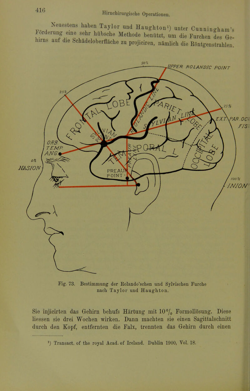 Hirnchirurgische Operationeu. Neuestens haben Taylor und Haughton') unter Cunningham's Forderung eine sehr hübsche Methode benutzt, um die Furchen des Ge- hirns auf d.e Schädeloberfläche zu projiciren, nämlich die Röntgenstrahlen Sie injicirten das Gehirn behufs Härtung mit 10% Formollösung. Diese Hessen sie drei Wochen wirken. Dann machten sie einen Sagittalschnitt durch den Kopf, entfernten die Falx, trennten das Gehirn durch einen ^) Transact. of the royal Acad. of Irelaud. Dublin 1900, Vol. 18.