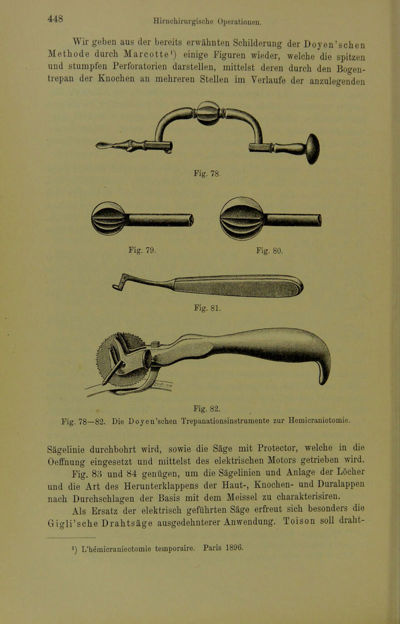 Wir geben aus der bereits erwähnten Schilderung der Doyen'schen Methode durch Marcotte^ einige Figuren wieder, welche die spitzen und stumpfen Perforatorien darstellen, mittelst deren durch den Bogen- trepan der Knochen an mehreren Stellen im Verlaufe der anzulegenden Fig. 82. Fig. 78—82. Die Dojen'scheu Trepanationsinstrumente zur Hemicraniotomie. Sägelinie durchbohrt wird, sowie die Säge mit Protector, welche in die Oeffnung eingesetzt und mittelst des elektrischen Motors getrieben wird. Fig. 8H und 84 genügen, um die Sägelinien und Anlage der Löcher und die Art des Herunterklappens der Haut-, Knochen- und Duralappen nach Durchschlagen der Basis mit dem Meissel zu charakterisiren. Als Ersatz der elektrisch geführten Säge erfreut sich besonders die Gigli'sche Drahtsäge ausgedehnterer Anwendung. Toison soll draht- ^) L'hemicrauiectomie teinporaire. Paris 1896.