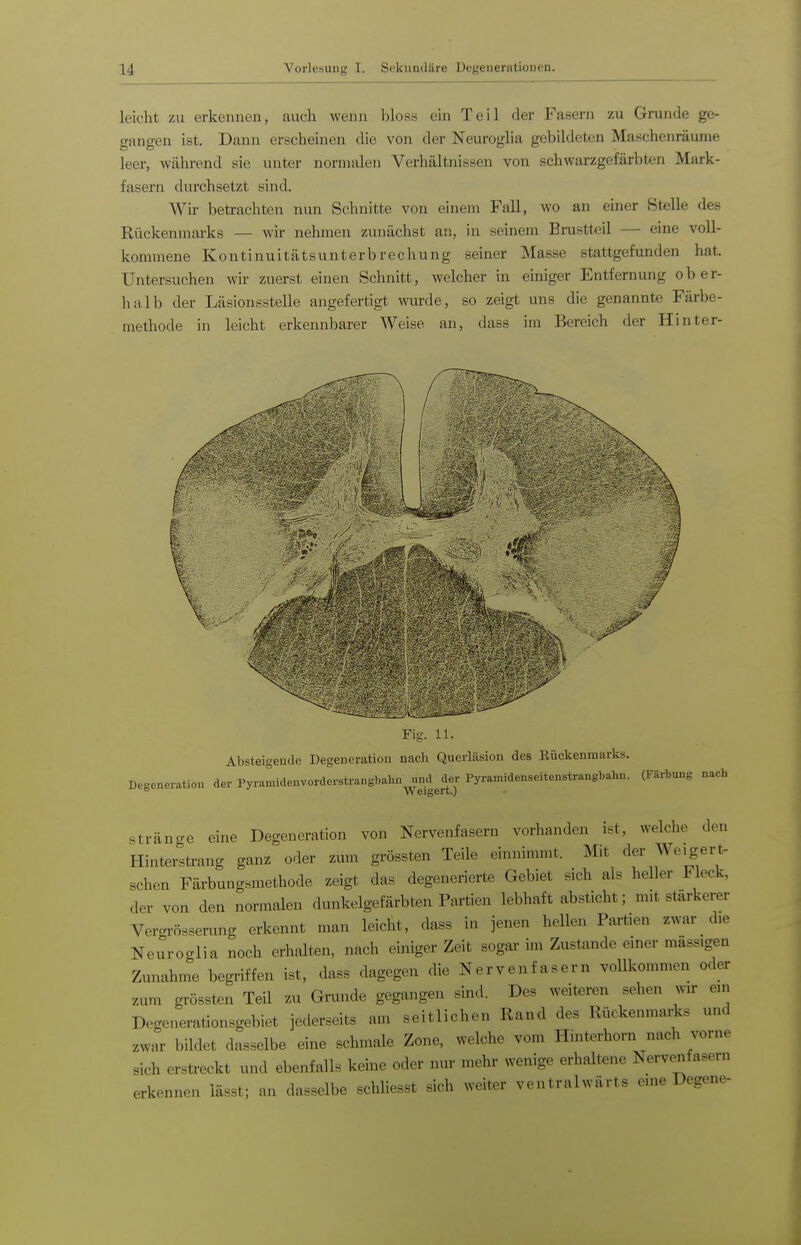 leicht zu erkennen, auch wenn bloss ein Teil der Fasern zu Grunde ge- gangen ist. Dann erscheinen die von der Neuroglia gebildeten Maschenräume leer, während sie unter normalen Verhältnissen von schwarzgefärbten Mark- fasern (hu'chsetzt sind. Wir betrachten nun Schnitte von einem Fall, wo an einer Stelle des Rückenmarks — wir nehmen zunächst an, in seinem Brustteil — eine voll- kommene Kontinuitätsunterbrechung seiner Masse stattgefunden hat. Untersuchen wir zuerst einen Schnitt, welcher in einiger Entfernung ober- halb der Läsionsstelle angefertigt Avurde, so zeigt uns die genannte Färbe- methode in leicht erkennbarer Weise an, dass im Bereich der Hinter- Fig. 11. Absteigende Degeneration nach Querläsion des Rückenmarks. Degeneration der Pyramideavorderstrangbahn^nd^der Pyramidenseitenstrangbahn. (Färbung nach Stränge eine Degeneration von Nervenfasern vorhanden ist, welche den Hinterstrang ganz oder zmn grössten Teile einnimmt. Mit der Weigert, sehen Färbungsmethode zeigt das degenerierte Gebiet sich als heller Fleck, der von den normalen dunkelgefärbten Partien lebhaft absticht; mit stärkerer Vercnrösserung erkennt man leicht, dass in jenen hellen Partien zwar d,e Neuroglia noch erhalten, nach einiger Zeit sogar im Zustande einer massigen Zunahme begriffen ist, dass dagegen die Nervenfasern vollkommen oder zum grössten TeU zu Grunde gegangen sind. Des weiteren sehen wir ein Degenerationsgebiet jederseits am seitlichen Rand des Rückenmarks und zwar bildet dasselbe eine schmale Zone, welche vom Hinterhorn nach vorne sich erstreckt und ebenfalls keine oder nur mehr wenige erhaltene Nervenfasern erkennen lässt; an dasselbe schliesst sich weiter ventralwärts eine Degene-