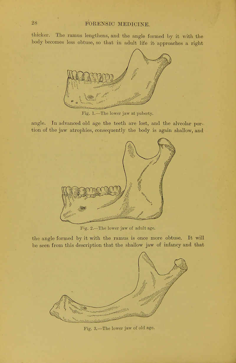 thicker. The ramus lengthens, and the angle formed by it v/ith the body becomes less obtuse, so that in adult life it approaches a right Fig. 1.—The lower jaw at j)ul)erty. angle. In advanced old age the teeth are lost, and the alveolar por- tion of the jaw atrophies, consequently the body is again shallow, and Fig. 2.—The lower jaw of adult age. tho angle formed by it with the ramus is once more obtuse. It will be seen from this description that the shallow jaw of infancy and that Fig. 3.—The lower jaw of old age.
