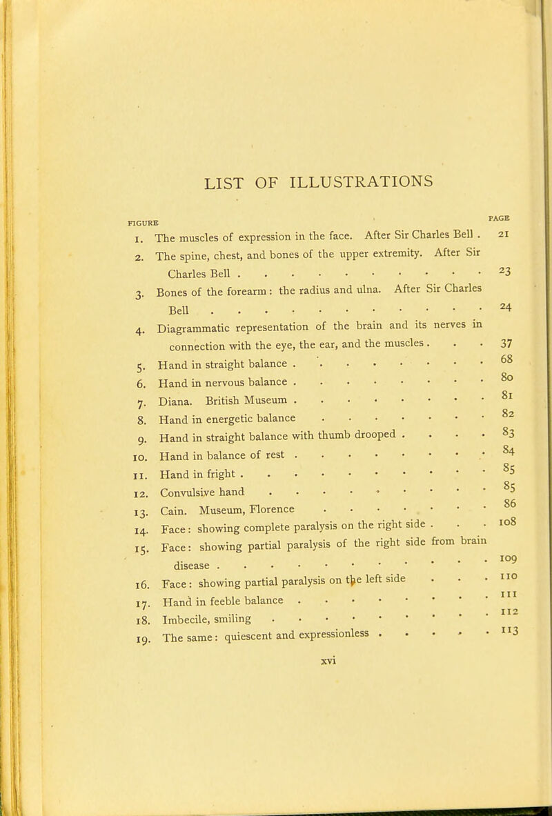 LIST OF ILLUSTRATIONS FIGURE ■ 1. The muscles of expression in the face. After Sir Charles Bell . 21 2. The spine, chest, and bones of the upper extremity. After Sir Charles Bell 23 3. Bones of the forearm: the radius and ulna. After Sir Charles BeU . . . • 24 4. Diagrammatic representation of the brain and its nerves in connection with the eye, the ear, and the muscles ... 37 5. Hand in straight balance 6. Hand in nervous balance ^° 7. Diana. 9 British Museum °' 8. Hand in energetic balance Hand in straight balance with thumb drooped .... 83 10. Hand in balance of rest • ^''^ 11. Hand in fright gr 12. Convulsive hand -' 13. Cain. Museum, Florence 14. Face : showing complete paralysis on the right side . . - 108 15. Face: showing partial paralysis of the right side from brain 109 disease 16. Face: showing partial paralysis on tVe left side . . .no 17. Hand in feeble balance 112 18. Imbecile, smiling 19. The same: quiescent and expressionless . . • - •