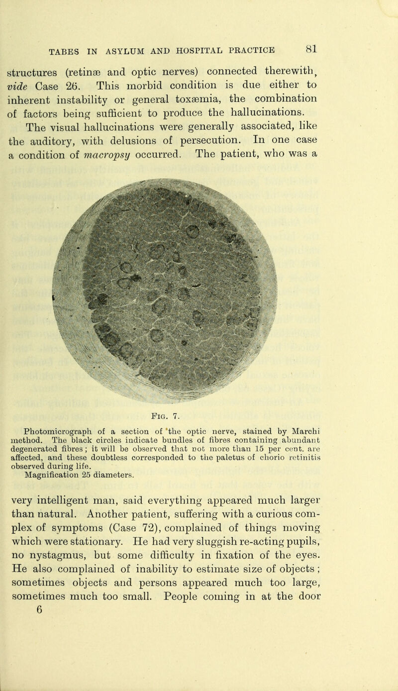 structures (retinae and optic nerves) connected therewith^ vide Case 26. This morbid condition is due either to inherent instabiHty or general toxsemia, the combination of factors being sufficient to produce the hallucinations. The visual hallucinations were generally associated, like the auditory, v^ith delusions of persecution. In one case a condition of macropsy occurred. The patient, who was a Fig. 7. Photomicrograph of a section of the optic nerve, stained by Marchi method. The black circles indicate bundles of fibres containing abundant degenerated fibres ; it will be observed that not more than 15 per cent, are affected, and these doubtless corresponded to the paletus of chorio retinitis observed during life. Magnification 25 diameters. very intelligent man, said everything appeared much larger than natural. Another patient, suffering with a curious com- plex of symptoms (Case 72), complained of things moving which were stationary. He had very sluggish re-acting pupils, no nystagmus, but some difficulty in fixation of the eyes. He also complained of inability to estimate size of objects ; sometimes objects and persons appeared much too large, sometimes much too small. People coming in at the door 6