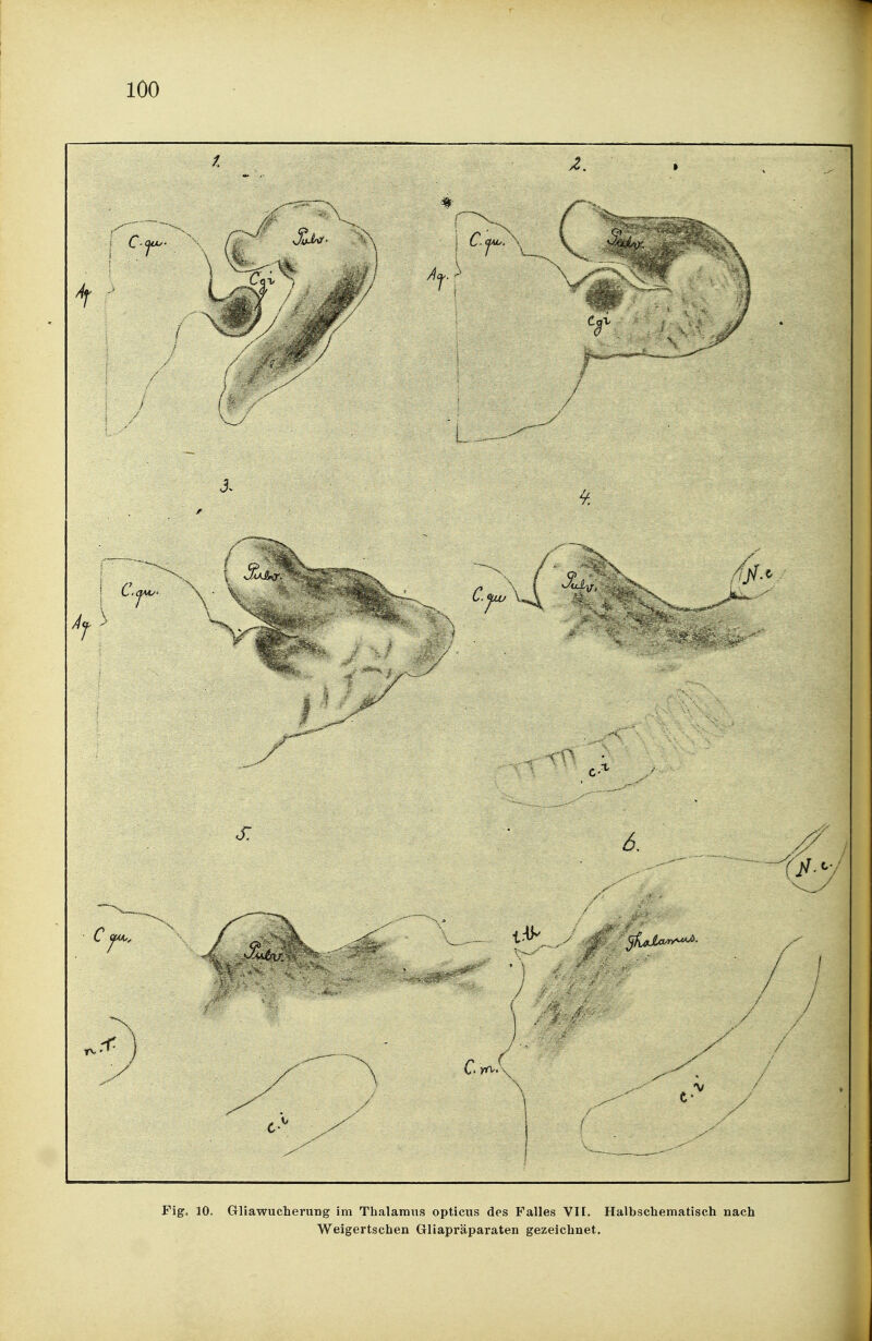 Fig. 10. Gliawucheruug im Thalamus opticus des Falles VH. Halbschematisch nach Weigertschen Gliapräparaten gezeichnet.