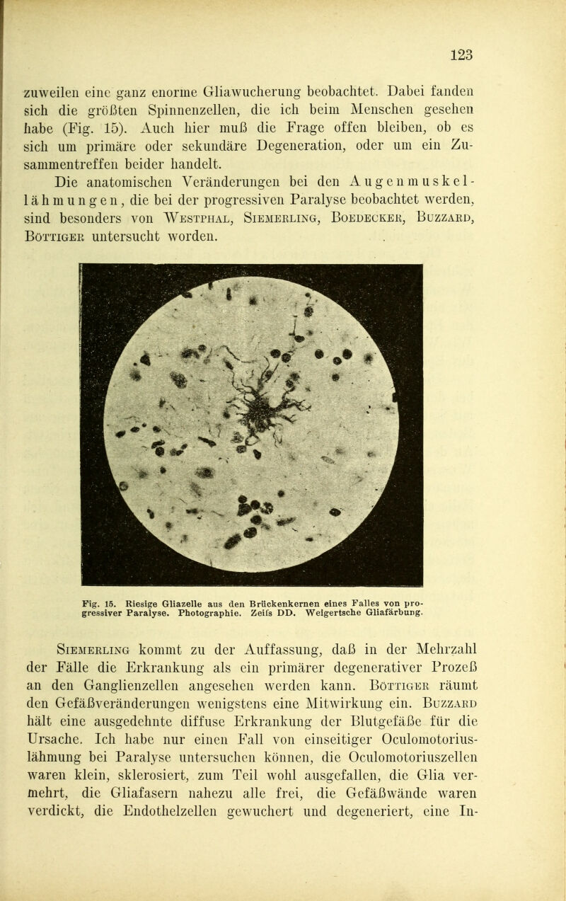 zuweilen eine ganz enorme Gliawiiclierung beobachtet. Dabei fanden sich die größten Spinnenzellen, die ich beim Menschen gesehen habe (Fig. 15). Auch hier muß die Frage offen bleiben, ob es sich um primäre oder sekundäre Degeneration, oder um ein Zu- sammentreffen beider handelt. Die anatomischen Veränderungen bei den Augenmuskel- 1 ä h m u n g e n, die bei der progressiven Paralyse beobachtet werden, sind besonders von Westphal, Siemerling, Boedeckek, Buzzard, Böttiger untersucht worden. Fig. 15. Riesige Gliazelle aus den Brückenkernen eines Falles von pro- gressiver Paralyse. Photographie. Zeifs DD. Weigertsche Gliafärbung. Siemerling kommt zu der Auffassung, daß in der Mehrzahl der Fälle die Erkrankung als ein primärer degenerativer Prozeß an den Ganglienzellen angesehen werden kann. Böttiger räumt den Gefäß Veränderungen wenigstens eine Mitwirkung ein. Buzzard hält eine ausgedehnte diffuse Erkrankung der Blutgefäße für die Ursache. Ich habe nur einen Fall von einseitiger Oculomotorius- lähmung bei Paralyse untersuchen können, die Oculomotoriuszellen waren klein, sklerosiert, zum Teil wohl ausgefallen, die Glia ver- mehrt, die Gliafasern nahezu alle frei, die Gefäßwände waren verdickt, die Endothelzellen gewuchert und degeneriert, eine In-