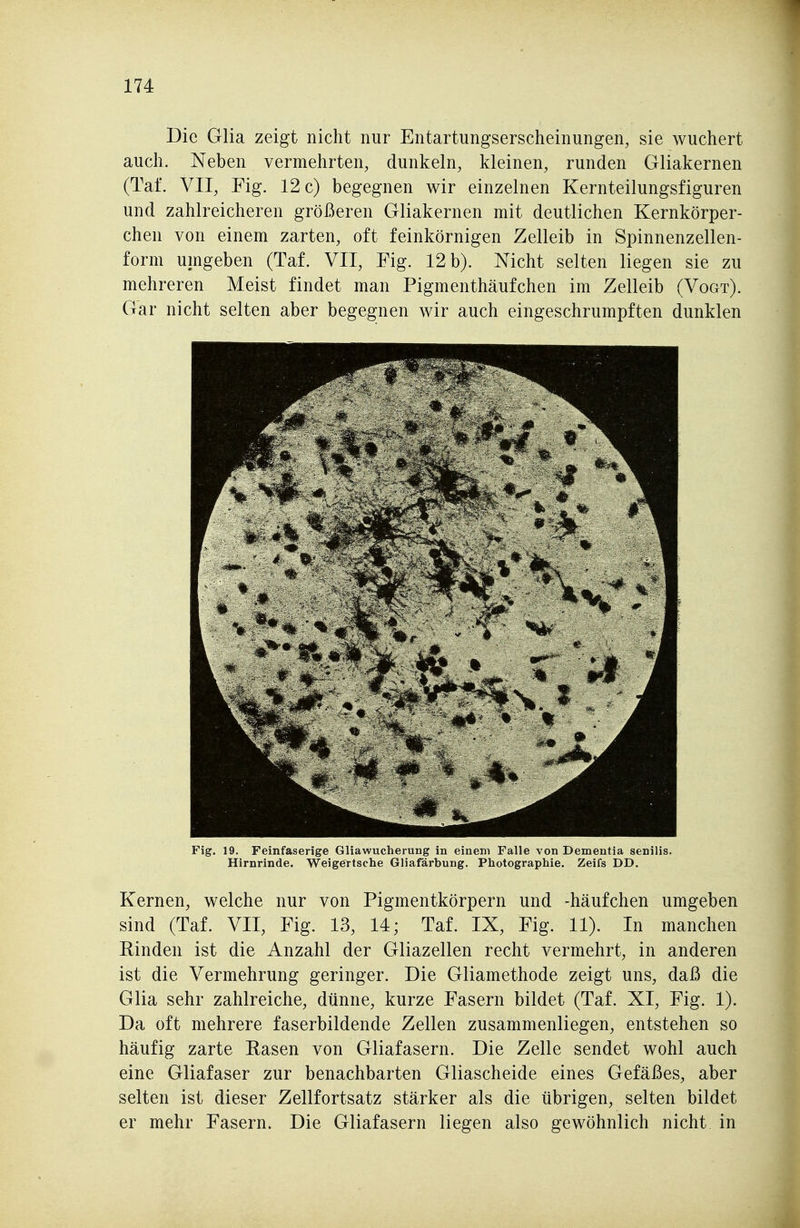 Die Glia zeigt nicht nur Entartungserscheinungen, sie wuchert auch. Neben vermehrten, dunkeln, kleinen, runden Gliakernen (Taf. VII, Fig. 12 c) begegnen wir einzelnen Kernteilungsfiguren und zahlreicheren größeren Gliakernen mit deutlichen Kernkörper- chen von einem zarten, oft feinkörnigen Zelleib in Spinnenzellen- form umgeben (Taf. VII, Fig. 12 b). Nicht selten liegen sie zu mehreren Meist findet man Pigmenthäufchen im Zelleib (Vogt). Gar nicht selten aber begeg:nen wir auch eingeschrumpften dunklen Fig. 19. Feinfaserige Gliawucherung in einem Falle von Dementia senilis. Hirnrinde. Weigertsche Gliafärbung. Photographie. Zeifs DD. Kernen, welche nur von Pigmentkörpern und -häufchen umgeben sind (Taf. VII, Fig. 13, 14; Taf. IX, Fig. 11). In manchen Rinden ist die Anzahl der Gliazellen recht vermehrt, in anderen ist die Vermehrung geringer. Die Gliamethode zeigt uns, daß die Glia sehr zahlreiche, dünne, kurze Fasern bildet (Taf. XI, Fig. 1). Da oft mehrere faserbildende Zellen zusammenliegen, entstehen so häufig zarte Easen von Gliafasern. Die Zelle sendet wohl auch eine Gliafaser zur benachbarten Gliascheide eines Gefäßes, aber selten ist dieser Zellfortsatz stärker als die übrigen, selten bildet er mehr Fasern. Die Gliafasern liegen also gewöhnlich nicht in