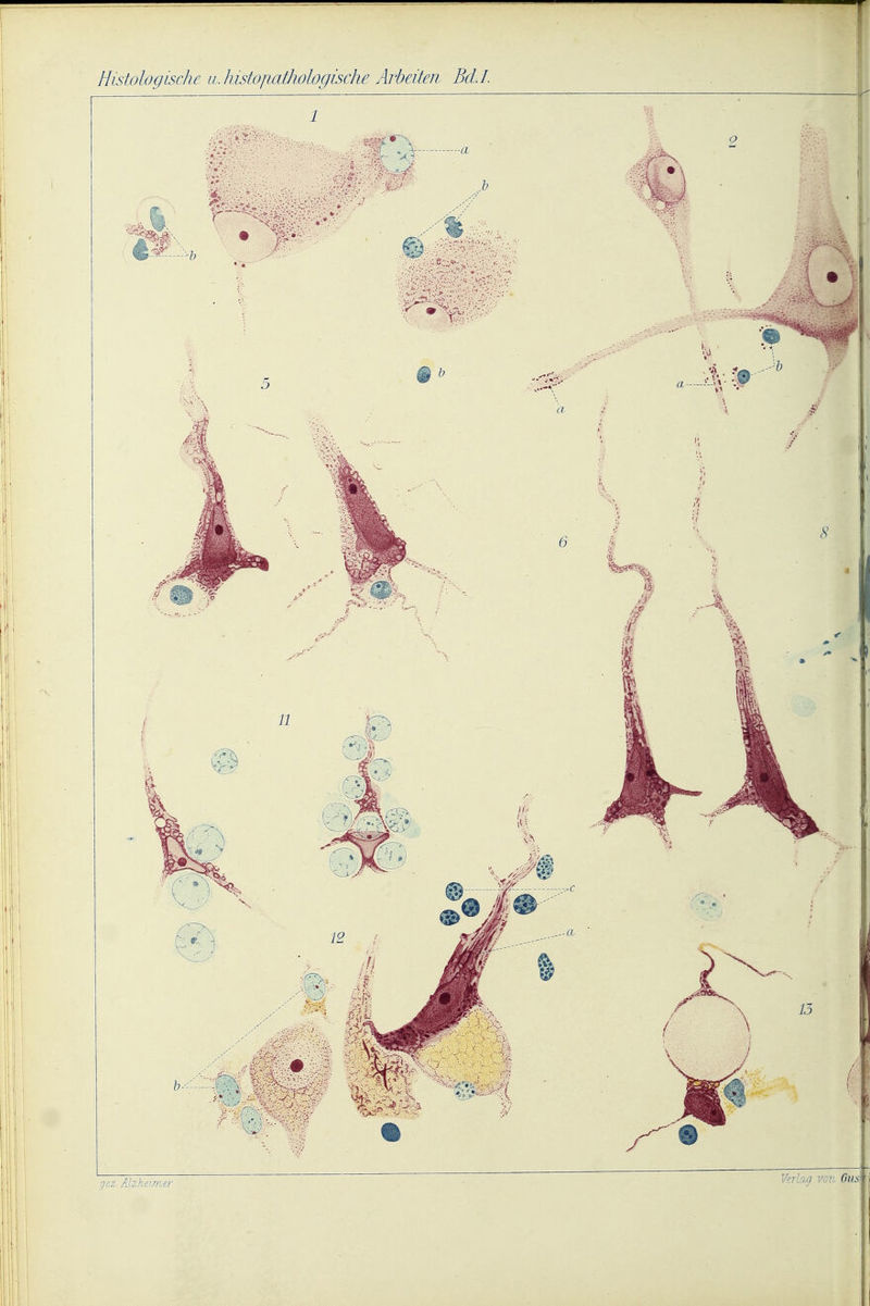 Histologische u.histofiathologische Arbeiten Bell. gez. Alzheimer
