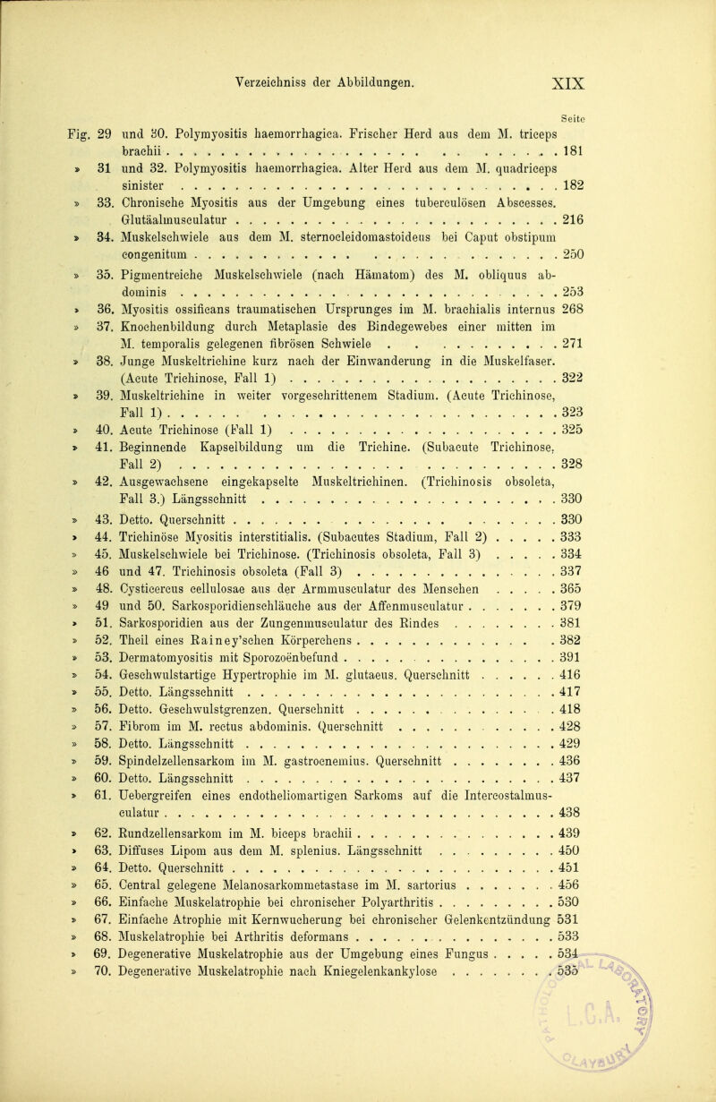 Seite Fig. 29 und '60. Polymyositis haemorrhagiea. Frischer Herd aus dem M. trieeps braehii . 181 » 31 und 32. Polymyositis haemorrhagiea. Alter Herd aus dem M, quadrieeps sinister 182 » 33. Chronische Myositis aus der Umgebung eines tubereulösen Abseesses. Glutäalmusculatur 216 » 34. Muskelsehwiele aus dem M. sternocleidomastoideiis bei Caput obstipum congenitum 250 » 35. Pigmentreiche Muskelschwiele (nach Hämatom) des M. obliquus ab- dominis 253 > 36. Myositis ossifieans traumatischen Ursprunges im M. brachialis internus 268 » 37. Knoehenbildung durch Metaplasie des Bindegewebes einer mitten im M. temporalis gelegenen fibrösen Schwiele 271 » 38. Junge Muskeltrichine kurz nach der Einwanderung in die Muskelfaser. (Acute Trichinose, Fall 1) 322 » 39. Muskeltricliine in weiter vorgeschrittenem Stadium. (Acute Trichinose, Fall 1) 323 * 40. Acute Trichinose (Fall 1) 325 » 41. Beginnende Kapselbildung um die Trichine. (Subaeute Trichinose, Fall 2) 328 » 42. Ausgewachsene eingekapselte Muskeltriehinen. (Trichinosis obsoleta, Fall 3.) Längsschnitt . 330 » 43. Detto. Querschnitt 330 > 44. Trichinöse Myositis interstitialis. (Subacutes Stadium, Fall 2) 333 » 45. Muskelschwiele bei Trichinose. (Trichinosis obsoleta, Fall 3) 334 » 46 und 47. Trichinosis obsoleta (Fall 3) 337 » 48. Cysticercus cellulosae aus der Armmuseulatur des Menschen 365 » 49 und 50. Sarkosporidienschläuche aus der Affenmusculatur 379 > 51. Sarkosporidien aus der Zungenmuseulatur des Rindes 381 » 52. Theil eines Rainey'schen Körperehens 382 » 53. Dermatomyositis mit Sporozoenbefund 391 » 54. Geschwulstartige Hypertrophie im M. glutaeus. Querschnitt 416 » 55. Detto. Längsschnitt 417 » 56. Detto. Geschwulstgrenzen. Querschnitt 418 » 57. Fibrom im M. rectus abdominis. Querschnitt 428 » 58. Detto. Längsschnitt 429 » 59. Spindelzellensarkom im M. gastrocnemius. Querschnitt 436 » 60. Detto. Längsschnitt 437 > 61. Uebergreifen eines endotheliomartigen Sarkoms auf die Intereostalmus- culatur 438 s> 62. Rundzellensarkom im M. biceps braehii 439 » 63. Diffuses Lipom aus dem M. splenius. Längsschnitt 450 » 64. Detto. Querschnitt 451 » 65. Central gelegene Melanosarkommetastase im M. sartorius 456 » 66. Einfache Muskelatrophie bei chronischer Polyarthritis 530 » 67. Einfache Atrophie mit Kernwucherung bei chronischer Gelenkentzündung 531 » 68. Muskelatrophie bei Arthritis deformans 533 » 69. Degenerative Muskelatrophie aus der Umgebung eines Fungus 534 ; » 70. Degenerative Muskelatrophie nach Kniegelenkankylose 535