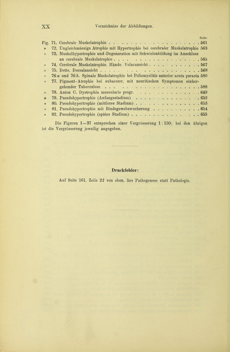 Seite Fig. 71. Cerebrale Muskelatrophie 561 > 72. Ungleiehmässige Atrophie mit Hypertrophie bei cerebraler Muskelatrophie 563 » 73. Muskelhypertrophie und-Degeneration mit Seh Wielenbildung im Ansehluss an cerebrale Muskelatrophie 565 » 74. Cerebrale Muskelatrophie. Hände. Volaransieht 567 » 75. Detto. Dorsalansicht 568 » 76 o und 76 h. Spinale Muskelatrophie bei Poliomyelitis anterior acuta peraeta 580 » 77. Pigment-Atrophie bei subaeuter, mit neuritisehen Symptomen einher- gehender Tuberculose . 588 » 78. Anton C. Dystrophia muscularis progr 649 » 79. Pseudohypertrophie (Anfangsstadium) 652 * 80. Pseudohypertrophie (mittleres Stadium) 653 » 81. Pseudohypertrophie mit Bindegewebswucherung 654 » 82. Pseudohypertrophie (spätes Stadium) 655 Die Figuren 1—37 entsprechen einer Vergrösserung 1:1.50; bei den übrigen ist die Vergrösserung jeweilig angegeben. Druckfehler: Auf Seite 161, Zeile 22 von oben, lies Pathogenese statt Pathologie.