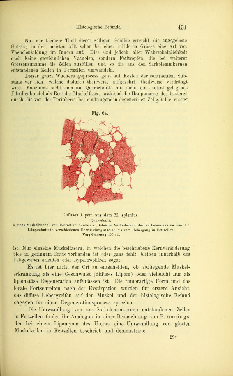 Nur der kleinere Theil dieser zelligeii Gebilde erreicht die angegebene Grösse; in den meisten tritt schon bei einer mittleren Grösse eine Art von Yacuolenbildung im Innern auf. Dies sind jedoch aller Wahrscheinlichkeit nach keine gewöhnlichen Yacuolen, sondern Fetttropfen, die bei weiterer Grössenzunahme die Zellen ausfüllen und so die aus den Sarkolemmkernen entstandenen Zellen in Fettzellen umwandeln. Dieser ganze Wucherungsprocess geht auf Kosten der contractilen Sub- stanz vor sich, welche dadurch theil weise aufgezehrt, theil weise verdrängt wird. Manchmal sieht man am Querschnitte nur mehr ein central gelegenes Fibrillenbündel als Rest der Muskelfaser, während die Hauptmasse der letzteren durch die von der Peripherie her eindringenden degenerirten Zellgebilde ersetzt Diffuses Lipom aus dem M. splenius. Querschnitt, Kleines Muskelbündel von Fettzellen durchsetzt. Gleiche Veränderung der Sarkolemmkerne wie am Längsschnitt in verschiedenen Entwicklungsstadieu bis zum Uebergang in Fettzellen. Vergrösserung 100 : 1. ist. Nur einzelne Muskelfasern, in welchen die beschriebene Kernveränderung blos in geringem Grade vorhanden ist oder ganz fehlt, bleiben innerhalb des Fettgewebes erhalten oder hypertrophiren sogar. Es ist hier nicht der Ort zu entscheiden, ob vorliegende Muskel- erkrankung als eine Geschwulst (diffuses Lipom) oder vielleicht nur als lipomatöse Degeneration aufzufassen ist. Die tumorartige Form und das locale Fortschreiten nach der Exstirpation würden für erstere Ansicht, das diffuse Uebergreifen auf den Muskel und der histologische Befund dagegen für einen Degenerationsprocess sprechen. Die Umwandlung von aus Sarkolemmkernen entstandenen Zellen in Fettzellen findet ihr Analogon in einer Beobachtung von Brünnings, der bei einem Lipomyom des Uterus eine Umwandlung von glatten Muskelzellen in Fettzellen beschrieb und demonstrirte. 29*