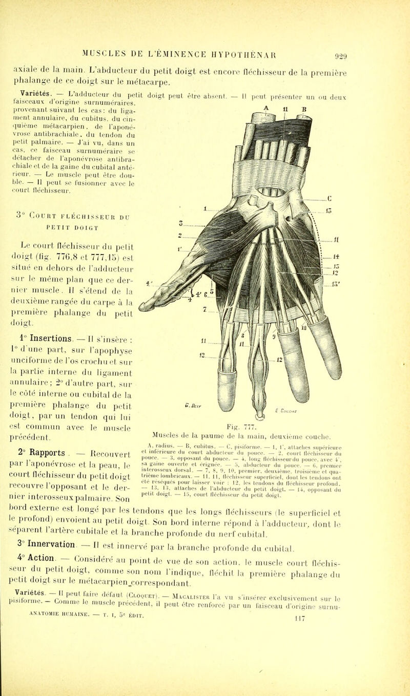 axiale de la main. L'abducteur du petit doigt est encoiv fléchisseur de la première phalange de ce doigt sur le métacarpe. Variétés. — L'adducteur du petit doigt peut être absent. — Il peut présenter un ou deux laisceaux d origine surnuméraires, provenant suivant les eas: du liga- ment annulaire, du cubitus, du cîn- ijuiéme métacarpien, de l'aponé- vrose antibrachiale, du tendon du petit palmaire. — J'ai vu, dans un cas. ce faisceau surnuméraire se détacher de l'aponévrose antibra- chiale et de la gaine du cubital anté- rieur. — Le muscle peut être dou- ble. — Il ])eut se fusionner avec le court lléchisseur. S Court kléchisseur du PETIT DOIGT Le court fléchisseur du petit doigt (tig. 776,8 et 777,15) est situé en dehors de l'adducteur sur' le même plan que ce der- nier muscle . 11 s'étend de la deuxième rangée du carpe à la première phalange du petit doigt. 1 Insertions. — Il s'insère : 1 d'une part, sut- l'apophyse unciforme de l'os crochu et sur la partie interne du ligament annulaire; d'autre part, sur le côté interne ou cubital de la première phalange du petit doigt, par un tendon qui lui est commun avec le muscle précédent. 2° Rapports — Recouvert par l'aponévrose et la peau, le court fléchisseur du petit doigt recouvre l'opposant et le der- nier interosseuxpalmaire. Son bord externe est longé par les tendons que les longs fléchisseurs (le superflciel et le profond) envoient au petit doigt. Son bord interne répond à l'adducteur, dont le séparent l'artère cubitale et la branche profonde du nerf cubital. 3' Innervation — [1 est innervé par la branche profonde du cubital. 4« Action. — Considéré au point de vue de son action, le muscle court fléchis- seiir du petit doigt, comme son nom l'indique, fléchit la première phalange du petit doigt sur le métacarpien,correspondant. .^r!'!*^'- -Co,S !^'''' ^^'T^'^-~ M^-^AUSTE^ l'a vu s'insérer exclusivement sur le Comme le muscle précèdent, il peut être renforce par un faisceau d'origine surnu- Fig. 777. Muscles de la paume de la main, deuxième couche. A, radius. — B, cubitus. — C, pisifornie. — 1, f, aUaclies supérieure et inlorieure du court abducicur du pouce. — i. court fléchisseur du pouce. — :i, opposant du pouce. — 4, long (loeliisseurdu pouce, avec 4', sa gaine ouverte et érignée. — .3, abducteur du pouce. — (i, premier interosseux dorsal. - 7, 8, 9, 10, premier, deuxième, troisième et qua- trième lombricaux. — 11, 11, lléchisseur superficiel, dont les tendons ont cte réséqués pour laisser voir : 12, les tendons du fléchisseur profond. — 1,3. 1,3, atlaclies de l'abducteur du petit doigt. — 14, opposant du petit doigt, — 1.5, court lléchisseur du petit doigt. pi si forme. .\N.\TOMIE Hr.\l.\I.\E. — T. I, o« ÉDIT. 117