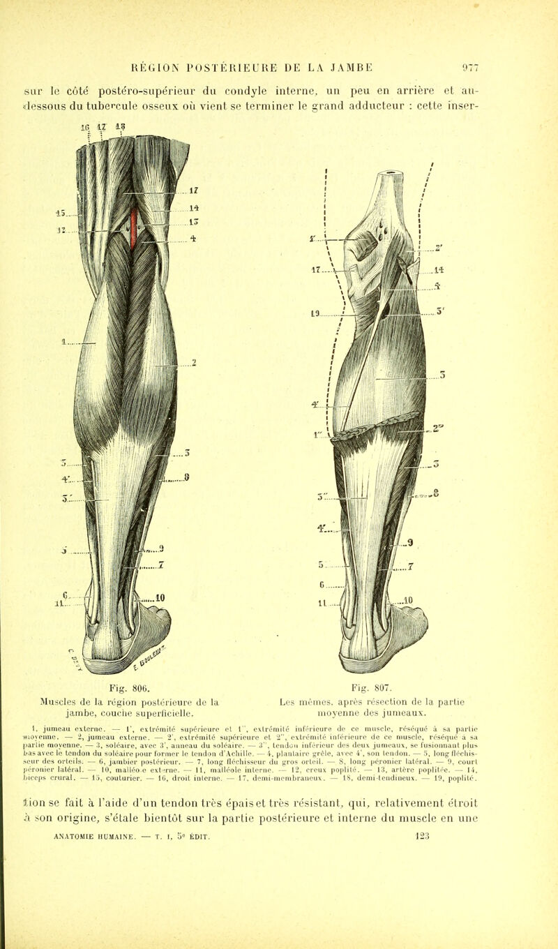 sur le coté postéro-siipérieur du condyle interne, un peu en arrière et au- dessous du tubei'cule osseux où vient se terminer le grand adducteur : cette inser- IG IZ 13 Fig. 806. Fig. 807. Muscles de la région postérieure do la Les mêmes, après résection de la partie jambe, couciie superficielle. moyenne des jumeaux. 1. jumeau externe. — 1', extrémité supérieure et 1 ', cvtréniité inférieure de ce muscle, réséqué à sa partie rtioyeane. — 2, jumeau externe. — 2', extrémité supérieure et 2, extrémité inférieure de ce muscle, réséqué a sa [larlie moyenne. — 3, soléaire, avec 3', anneau du soléaire. — 3, IcnJoii inférieur des deux jumeaux, se fusionnant plus bas avec le tendon du soléaire pour former le tendon d'Acliille. — 4, plantaire grêle, avec 4', son tendon. — 5, long flécliis- >eur des orteils. — tt, jainbier postérieur. — 7, long fléchisseur du gros orleil. — 8. long péronier latéral. — 9, court prronier latéral. — 10, malléoe extn'ne. — 11, malléole interne. — 12, creux poplité. — 13, artère poplitée. — 14, liiceps crural. — 1.5, couturier. — IG, droit interne. — 17, demi-niembraneux. — 18, demi-tendineux. — 19, poplité. lion se fait à l'aide d'un tendon très t5paiset très re'sistant, qui, relativement étroit à son origine, s'étale bienti_H sur la partie postérieure et interne du muscle en une ANATOMIE HUMAINE. — T. I, 5° ÉDIT. 123