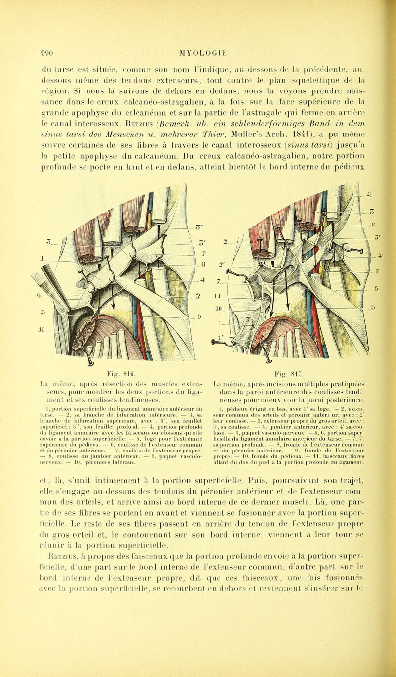 du tarse est située, comme son nom l'indique, au-dessous de la précédente, au- dessous même des tendons extenseurs, tout contre le plan squelettique de la région. Si novis la suivons de dehors en dedans, nous la voyons prendre nais- sance dans le creux calcanéo-astragalien, à la fois sur la face supérieure de la grande apophyse du calcanéum et sur la partie de l'astragale qui ferme en arrière le canal interosseux. Retzius {Bemerk. ûb. ein schleuderfôrmiges Band in dem sinus tarsi des Menschen u. mehrerer Thier, MuUer's Arch. 1841), a pu mêm(î suivre certaines de ses libres à travers le canal interosseux {sinus tarsi) jusqu'à la petite apophyse du calcanéum. Du creux calcanéo-astragalien, notre portion profonde se porte en haut et en dedans, atteint bientôt le bord interne du pédieux Fig. 816. La même, après résection des muscles exten- seurs, pour montrer les deux portions du liga- ment et ses coulisses tendineuses. 1, portion superficielle du ligament annulaire antérieur du larse. — 2, sa branche de bifurcation intérieure. — 3, sa branche de bifurcation supérieure, avec ; 3', son feuillet superficiel ; 3 ', son feuillet profond. — 4, porlion profonde du ligament annulaire avec les faisceaux ou cloisons qu'elle envoie à la portion superficielle. — 5, loge pour l'extrémité supérieure du pédieux. — G, coulisse de l'extenseur commun «t du péronier antérieur. — 7, coulisse de l'extenseur propre. — 8, coulisse du jambicr antérieur. — 0, paquet vasculo- nerveux. — 10, péroniers latéraux. Fig. 817. La même, après incisions multiples pratiquées dans la paroi antérieure des coulisses tendi neuscs pour mieux voir la paroi postérieure. 1. pédieux érigné en bas, avec 1' sa loge. — 2, exten- seur commun des orteils et péronier antéri ur, avec : 2' leur coulisse. — 3, extenseur propre du gros orteil, avec : 3', sa coulisse. — 4, jambier antérieur, avec : 4' sa cou- lisse. — 5, paquet vasculo-nerveux. — 6, 6, portion super- ficielle du ligament annulaire antérieur du tarse. — 7, 7, sa portion profonde. — 8, fronde de l'extenseur commun et du péronier antérieur, — 9, fronde de l'extenseur propre. — 10, fronde du pédieux. — 11, faisceaux fibres allant du dos du pied à la portion profonde du ligament. et, là, s'unit intimement à la portion superficielle. Puis, poursuivant son trajet, elle s'engage au-dessous des tendons du péronier antérieur et de l'extenseur com- mvin des orteils, et arrive ainsi au bord interne de ce dernier muscle. Là, une par- tie de ses fibres se portent en avant et viennent se fusionner avec la portion super- ficielle. Le reste de ses fibres passent en arrière du tendon de l'extenseur propre du gros orteil et, le contournant sur son bord interne, viennent à leur tour se réunir à la portion superficielle. Retzius, à propos des faisceaux que la portion profonde envoie à la portion super- ficielle, d'une part sur le bord interne de l'extenseur commun, d'autre part sur le bord interne de l'extenseur propre, dit que ces faisceaux, une fois fusionnés avec la portion superficielle, se recourbent en dehors et reviennent s'insérer sur le