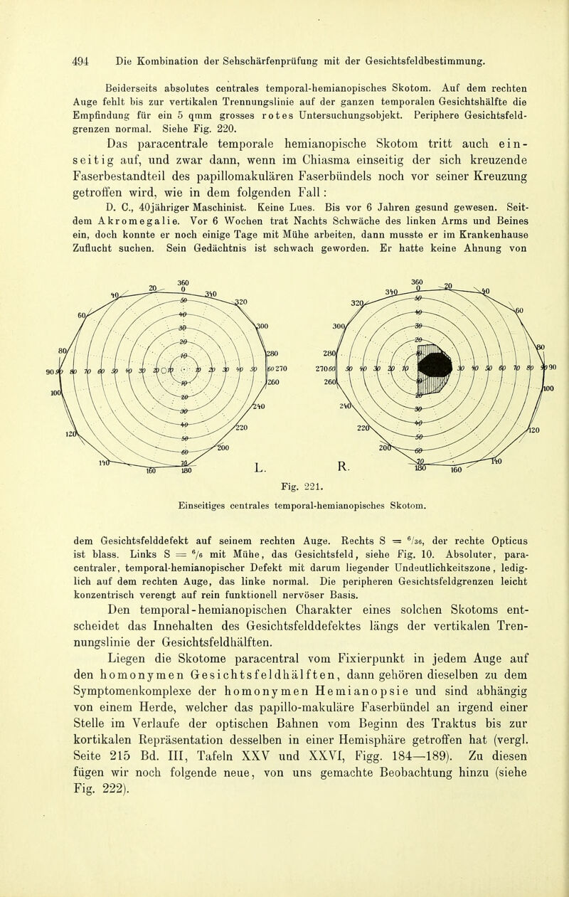 Beiderseits absolutes centrales temporal-hemianopisches Skotom. Auf dem rechten Auge fehlt bis zur vertikalen Trennungslinie auf der ganzen temporalen Gesichtshälfte die Empfindung für ein 5 qmm grosses rotes üntersuchungsobjekt. Periphere Gesichtsfeld- grenzen normal. Siehe Fig. 220. Das paracentrale temporale hemianopische Skotom tritt auch ein- seitig auf, und zwar dann, wenn im Chiasma einseitig der sich kreuzende Faserbestandteil des papillomakulären Faserbündels noch vor seiner Kreuzung getroffen wird, wie in dem folgenden Fall: D. C, 40jähriger Maschinist. Keine Lues. Bis vor 6 Jahren gesund gewesen. Seit- dem Akromegalie. Vor 6 Wochen trat Nachts Schwäche des linken Arms und Beines ein, doch konnte er noch einige Tage mit Mühe arbeiten, dann musste er im Krankenhause Zuflucht suchen. Sein Gedächtnis ist schwach geworden. Er hatte keine Ahnung von Fig. 221. Einseitiges centrales temporal-hemianopisches Skotom. dem Gesichtsfelddefekt auf seinem rechten Auge. Rechts S = ^Ise, der rechte Opticus ist blass. Links S — ^/e mit Mühe, das Gesichtsfeld, siehe Pig, 10. Absoluter, para- centraler, temporal-hemianopischer Defekt mit darum liegender Undeutlichkeitszone , ledig- lich auf dem rechten Auge, das linke normal. Die peripheren Gesichtsfeldgrenzen leicht konzentrisch verengt auf rein funktionell nervöser Basis. Den temporal-hemianopischen Charakter eines solchen Skotoms ent- scheidet das Innehalten des Gesichtsfelddefektes längs der vertikalen Tren- nungslinie der Gesichtsfeldhälften. Liegen die Skotome paracentral vom Fixierpunkt in jedem Auge auf den homonymen Gesichtsfeldhälften, dann gehören dieselben zu dem Symptomenkomplexe der homonymen Hemianopsie und sind abhängig von einem Herde, welcher das papillo-makuläre Faserbündel an irgend einer Stelle im Verlaufe der optischen Bahnen vom Beginn des Traktus bis zur kortikalen Repräsentation desselben in einer Hemisphäre getroffen hat (vergl. Seite 215 Bd. HI, Tafeln XXV und XXVI, Figg. 184—189). Zu diesen fügen wir noch folgende neue, von uns gemachte Beobachtung hinzu (siehe Fig. 222).