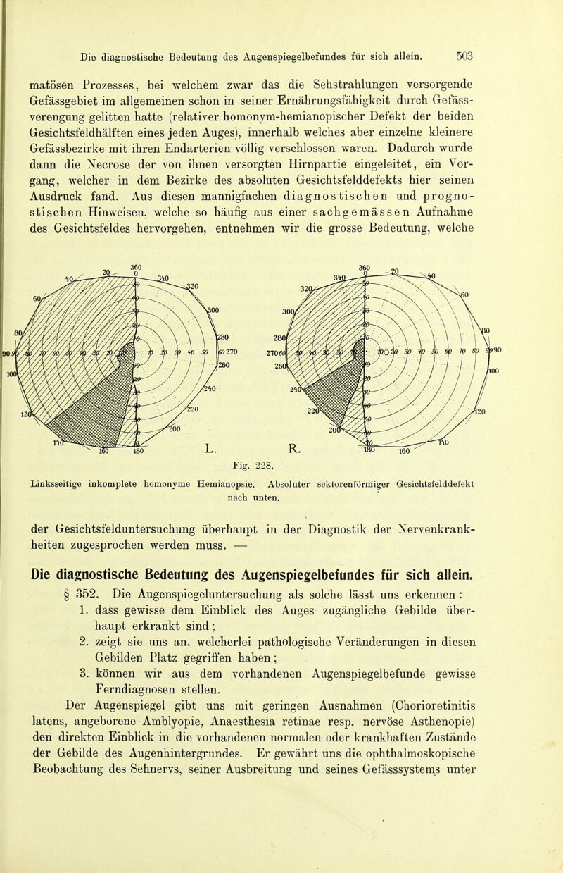 matösen Prozesses, bei welchem zwar das die Sehstrahlungen versorgende Gefässgebiet im allgemeinen schon in seiner Ernährungsfähigkeit durch Gefäss- verengung gelitten hatte (relativer homonym-hemianopischer Defekt der beiden Gesichtsfeldhälften eines jeden Auges), innerhalb welches aber einzelne kleinere Gefässbezirke mit ihren Endarterien völlig verschlossen waren. Dadurch wurde dann die Necrose der von ihnen versorgten Hirnpartie eingeleitet, ein Vor- gang, welcher in dem Bezirke des absoluten Gesichtsfelddefekts hier seinen Ausdruck fand. Aus diesen mannigfachen diagnostischen und progno- stischen Hinweisen, welche so häufig aus einer sachgemässen Aufnahme des Gesichtsfeldes hervorgehen, entnehmen wir die grosse Bedeutung, welche -20 Fig. 228, Linksseitige inkomplete homonyme Hemianopsie. Absoluter sektorenförmiger Gesichtsfelddefekt nach unten. der Gesichtsfelduntersuchung überhaupt in der Diagnostik der Nervenkrank- heiten zugesprochen werden muss. — Die diagnostische Bedeutung des Augenspiegelbefundes für sich allein. § 352. Die Augenspiegeluntersuchung als solche lässt uns erkennen : 1. dass gewisse dem Einblick des Auges zugängliche Gebilde über- haupt erkrankt sind; 2. zeigt sie uns an, welcherlei pathologische Veränderungen in diesen Gebilden Platz gegrifien haben; 3. können wir aus dem vorhandenen Augenspiegelbefunde gewisse Ferndiagnosen stellen. Der Augenspiegel gibt uns mit geringen Ausnahmen (Chorioretinitis latens, angeborene Amblyopie, Anaesthesia retinae resp. nervöse Asthenopie) den direkten Einblick in die vorhandenen normalen oder krankhaften Zustände der Gebilde des Augenhintergrundes. Er gewährt uns die ophthalmoskopische Beobachtung des Sehnervs, seiner Ausbreitung und seines Gefässsysteras unter