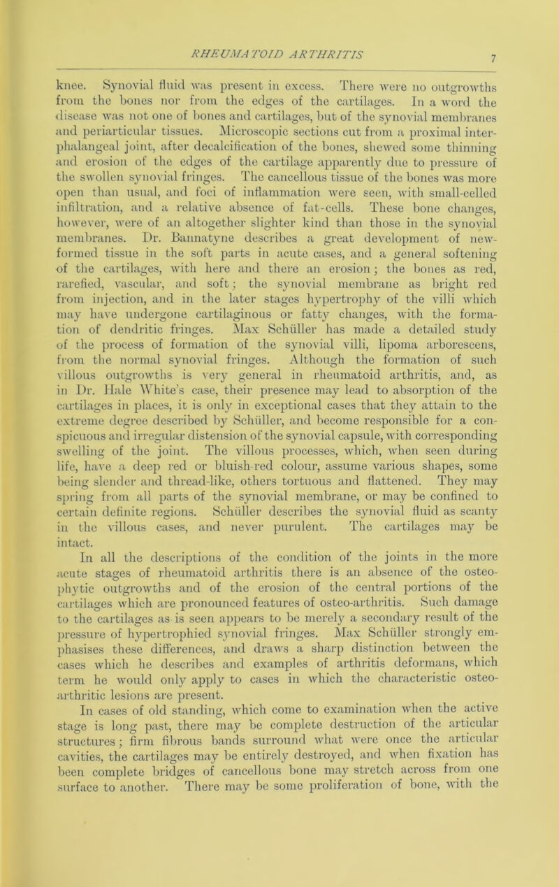 7 knee. Synovial fluid was present in excess. There were no outgrowths from the bones nor from the edges of the cartilages. In a word the <lisease was not one of bones and cartilages, but of the synovial membranes and periarticular tissues. INIicroscopic sections cut from a ^jroximal inter- phalangeal joint, after decalcificatiou of the bones, shewed some thinning and erosion of the edges of the cartilage apparently due to pressure of the swollen synovial fringes. The cancellous tissue of the bones was more open than usual, and foci of inflammation were seen, Avith small-celled infiltration, and a relative absence of fat-cells. These bone changes, however, were of an altogether slighter kind than those in the s}'novial membranes. Dr. Bannatyne describes a great development of new- formed tissue in the soft parts in acute cases, and a general softening of the cartilages, with here and there an erosion; the bones as red, rarefied, vascular, and soft; the synovial membrane as bright red from injection, and in the later stages hypertrophy of the villi Avhich may have undergone cartilaginous or fatty changes, Avith the forma- tion of dendritic fringes. Max Schuller has made a detailed study of the i)i'ocess of formation of the synovial villi, lipoma arborescens, from the normal synoA'ial fringes. Although the formation of such A’iHous outgroAvths is very general in rheumatoid arthritis, and, as in Dr. Hale White’s case, their presence may lead to absorption of the cartilages in places, it is only in exceptional cases that they attain to the e.xtreme degree described by Schiiller, and become responsible for a con- spicuous and iiTegular distension of the synovial capsule, Avith corresponding swelling of the joint. The villous processes, Avhich, Avhen seen during life, have a deep red or bluish-red colour, assume various shapes, some being slender and thread-like, others tortuous and flattened. They may spring from all parts of the synoAual membrane, or may be confined to certain definite regions. Schiiller describes the synovial fluid as scanty in the villous cases, and never purulent. The caidilages may be intact. In all the descriptions of the condition of the joints in the more acute stages of rheumatoid arthritis there is an absence of the osteo- phytic outgroAvths and of the erosion of the central portions of the cartilages Avhich are pronounced features of osteo-arthritis. Such damage to the cartilages as is seen appears to be merely a secondary result of the pressure of hypertrophied synovial fringes. Max Schiiller strongly em- phasises these differences, and draAvs a sharp distinction betAveen the cases Avhich he describes and examples of arthritis deformans, Avhich term he Avould only apply to cases in Avhich the characteristic osteo- arthritic lesions are present. In cases of old standing, AA^hich come to examination Avhen the active stage is long past, there may be complete destruction of the articular structures; film fibrous bands surround Avhat Avere once the articular caAuties, the cartilages may be entirely destroyed, and Avhen fixation has been complete bridges of cancellous bone may stretch across from one -surface to another.  There may be some proliferation of bone, Avith the
