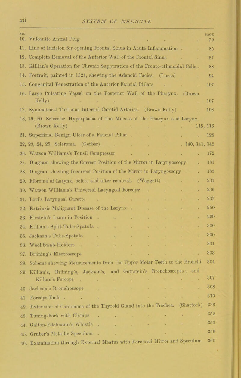 FMJ. ‘ PAGE 10. Vulcanite Antral Plug ....... 79 11. Line of Incision for opening Frontal Sinus in Acute Inflammation . . 85 12. Complete Removal of the Anterior Wall of the Frontal Sinus . . 87 13. Killian’s Operation for Chronic Suppuration of the Fronto-etlimoidal Cells . 88 14. Portrait, painted in 1521, shewing the Adenoid Facies. (Lucas) . . 94 15. Congenital Fenestration of the Anterior Faucial Pillars . . 107 16. Large Pulsating Vessel on the Posterior Wall of the Pharynx. (Brown Kelly) ......... 107 17. Symmetrical Tortuous Internal Carotid Arteries. (Brown Kelly) . . 108 18. 19, 20. Sclerotic Hyperplasia of the Mucosa of the Pharynx and Larynx. (Brown Kelly) ....... 115, 116 21. Superficial Benign Ulcer of a Faucial Pillar ..... 128 22, 23, 24, 25. Scleroma. (Gerber) ..... 140, 141, 142 26. Watson Williams’s Tonsil Compressor ..... 172 27. Diagram shewing the Correct Position of the Mirror in Laryngoscopy . 181 28. Diagram shewing Incorrect Position of the Mirror in Laryngoscopy . 183 29. Fibroma of Larynx, before and after removal. (Waggett) . . . 231 30. Watson Williams’s Universal Laryngeal Forceps- .... 236 31. Lori’s Laryngeal Curette ....... 237' 32. Extrinsic Malignant Disease of the Larynx ..... 250 33. Kirstein’s Lamp in Position ....... 299 34. Killian’s Split-Tube-Spatula ....... 300 35. Jackson’s Tube-Spatula ....... 300 36. Wool Swab-Holders 301 37. Briining’s Electroscope 303 38. Scheme shewing Measurements from the Upper Molar Teeth to the Bronchi 304 39. Killian’s, Briining’s, Jackson’s, and Gottstein’s Bronchoscopes; and Killian’s Forceps ..•••■•• 30/ 40. Jackson’s Bronchoscope 308 41. Forceps-Ends 42. Extension of Carcinoma of the Thyroid Gland into the Trachea. (Shattock) 336 43. Tuning-Fork with Clamps ...•••• 352 44. Galton-Edelmann’s Whistle ...••• 45. Gruber's Metallic Speculum 359 46. Examination through External Meatus with Forehead Mirror and Speculum 360