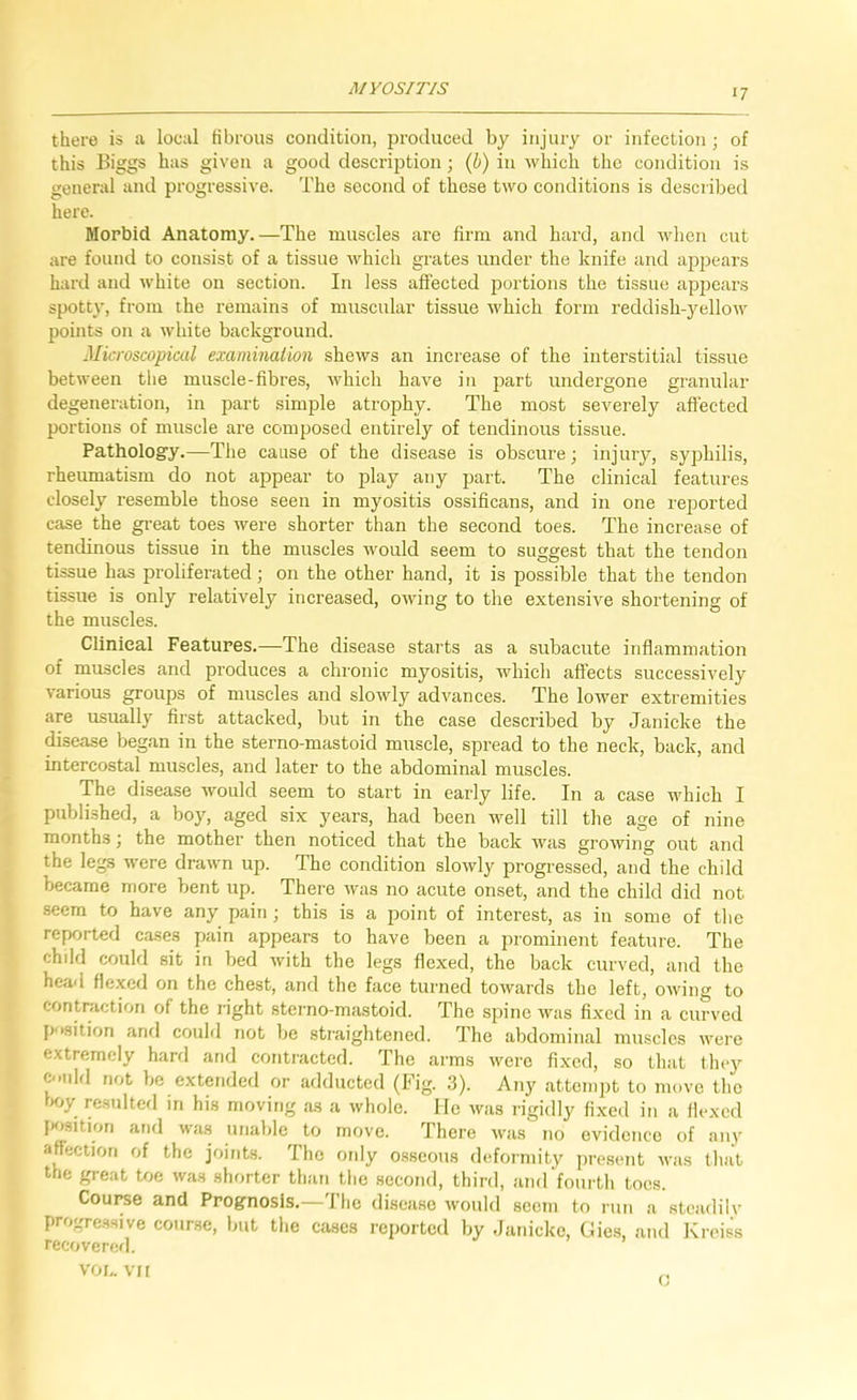 MYOSITIS there is n local fibrous condition, produced by injury or infection; of this Biggs has given a good description; ih) in which the condition is general and progressive. The second of these two conditions is described here. Morbid Anatomy.—The muscles are firm and hard, and when cut are found to consist of a tissue which grates under the knife and appears hard and white on section. In less affected portions the tissue appears spotty, from the remains of muscular tissue which form reddish-yellow points on a white background. Microscopical examinaiion shews an increase of the interstitial tissue between the muscle-fibres, which have in part undergone granular degeneration, in part simple atrophy. The most severely afiected portions of muscle are composed entirely of tendinous tissue. Pathology.—The cause of the disease is obscure; injury, syphilis, rheumatism do not appear to play any part. The clinical features closely resemble those seen in myositis ossificans, and in one reported case the great toes were shorter than the second toes. The increase of tendinous tissue in the muscles would seem to suggest that the tendon tissue has proliferated; on the other hand, it is possible that the tendon tissue is only relatively increased, owing to the extensive shortening of the muscles. Clinical Features.—The disease starts as a subacute inflammation of muscles and produces a chronic myositis, Avhich affects successively various groups of muscles and slowly advances. The lower extremities are usually first attacked, but in the case described by Janicke the disease began in the sterno-mastoid muscle, spread to the neck, back, and intercostal muscles, and later to the abdominal muscles. The disease would seem to start in early life. In a case which I published, a boj-, aged six years, had been well till the age of nine months; the mother then noticed that the back was growing out and the legs were drawn up. The condition slowly progressed, and the child became more bent up. There was no acute onset, and the child did not seem to have any pain; this is a point of interest, as in some of the reported cases pain appears to have been a prominent feature. The chdd could sit in bed with the legs flexed, the back curved, and the head flexed on the chest, and the face turned towards the left, owing to contraction of the right sterno-mastoid. The spine was fi.xed in a curved [joaition anfl couhl not be straightened. The abdominal muscles were extremely harrl and contracted. The arms were fixed, so that they c-.nld not be extended or adducted (Fig. 3). Any attempt to move the \x>y resulted in his moving ,'is a whole, lie was rigidly fixed in a flexed jsisition and was unable to move. flhere Avas no evidence of anv aftection of the joints. The only o.sseous defoiniity present was that the great toe was shorter than the second, third, and fourth toes. Couree and Prognosis.—'I’lic disease would seem to run a steadilv progressive course, Imt the cases reported by Janicke, Gies, and Kroiss recovercf). VO I.. VI t Vj