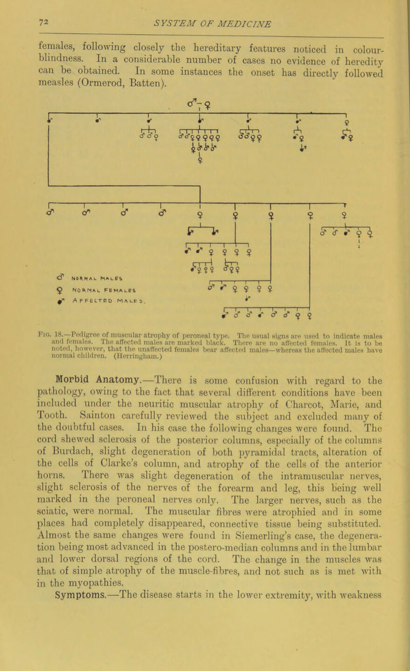 females, following closely the hereditary features noticed in colour- blindness. In a considerable number of cases no evidence of heredity can be obtained. In some instances the onset has directly folloAved measles (Ormerod, Batten). r 1 Ir i* T Hp a cf 9 ^^99999 ^^99 rK % 1— cT ~T“ cf I 9 _L_ T % 1— ^ NOHMAi. males 5 normal females ff' ApFEtreo MALES. $ ? ? o' e 5 9 ir 5 ~r S 'Vk I Fio. 18.—Pedigree of muscular atrophy of peroneal type. The usual signs are used to indicate males and lemales. The affected males are marked black. There are no affected females. It is to be noted, however, that the unafl'ected females bear affected males—whereas the affected males have normal children. (Herringham.) Mopbid Anatomy.—There is some confusion with regard to the pathology, owing to the fact that several different conditions have been included under the neuritic muscular atrophy of Charcot, Marie, and Tooth. Sainton carefully reviewed the subject and excluded many of the doubtful cases. In his case the following changes were found. The cord shewed sclerosis of the posterior columns, especially of the columns of Burdach, slight degeneration of lioth pyramidal tracts, alteration of the cells of Clarke’s column, and atrophy of the cells of the anterior horns. There was slight degeneration of the intramuscular nerves, slight sclerosis of the nerves of the forearm and leg, this being well marked in the pei'oneal nerves only. The larger nerves, such as the sciatic, were normal. The muscular fibres were atrophied and in some places had completely disappeared, connective tissue being substituted. Almost the same changes were found in Siemerling’s case, the degenera- tion being most advanced in the postero-median columns and in the lumbar and lower dorsal regions of the cord. The change in the muscles was that of simple atrophy of the muscle-fibres, and not such as is met with in the myopathies. Symptoms.—The disease starts in the lower extremitj’^, ivith weakness