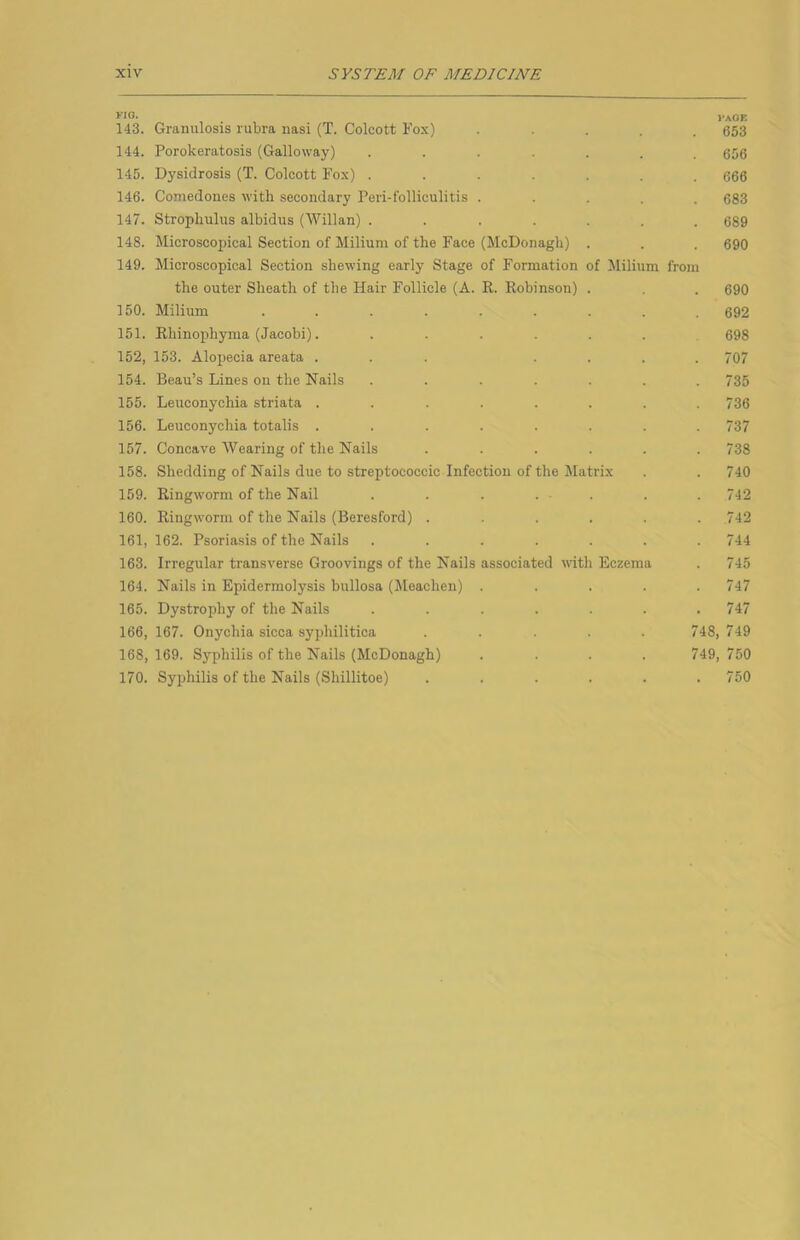 1-aOE 143. Granulosis rubra nasi (T. Colcott Fox) • • . . . 653 144. Porokeratosis (Galloway) ....... 656 145. Dysidrosis (T. Colcott Fox) ....... 666 146. Comedones with secondary Peri-folliculitis ..... 683 147. Strophulus albidus (Willan) ....... 689 148. Microscopical Section of Milium of the Face (McDonagh) . . . 690 149. Microscopical Section shewing early Stage of Formation of Milium from the outer Sheath of the Hair Follicle (A. R. Robinson) . . 690 150. Milium ......... 692 151. Rliinophyma (Jacobi). ...... 698 152. 153. Alopecia areata ... .... 707 154. Beau’s Lines on the Nails ....... 735 155. Leuconychia striata . . . . . . . .736 156. Leuconychia totalis ........ 737 157. Concave AVearing of the Nails ...... 738 158. Shedding of Nails due to streptococcic Infection of the Matrix . . 740 159. Ringworm of the Nail . . . ... . . 742 160. Ringworm of the Nails (Beresford) ...... 742 161. 162. Psoriasis of the Nails ....... 744 163. Irregular transverse Groovings of the Nails associated with Eczema . 745 164. Nails in Epidermolysis bullosa (Meachen) ..... 747 165. Dystrophy of the Nails ....... 747 166. 167. Onychia sicca syphilitica ..... 748, 749 168, 169. Syphilis of the Nails (McDonagh) .... 749, 750 170. Syphilis of the Nails (Shillitoe) . . . . . .750