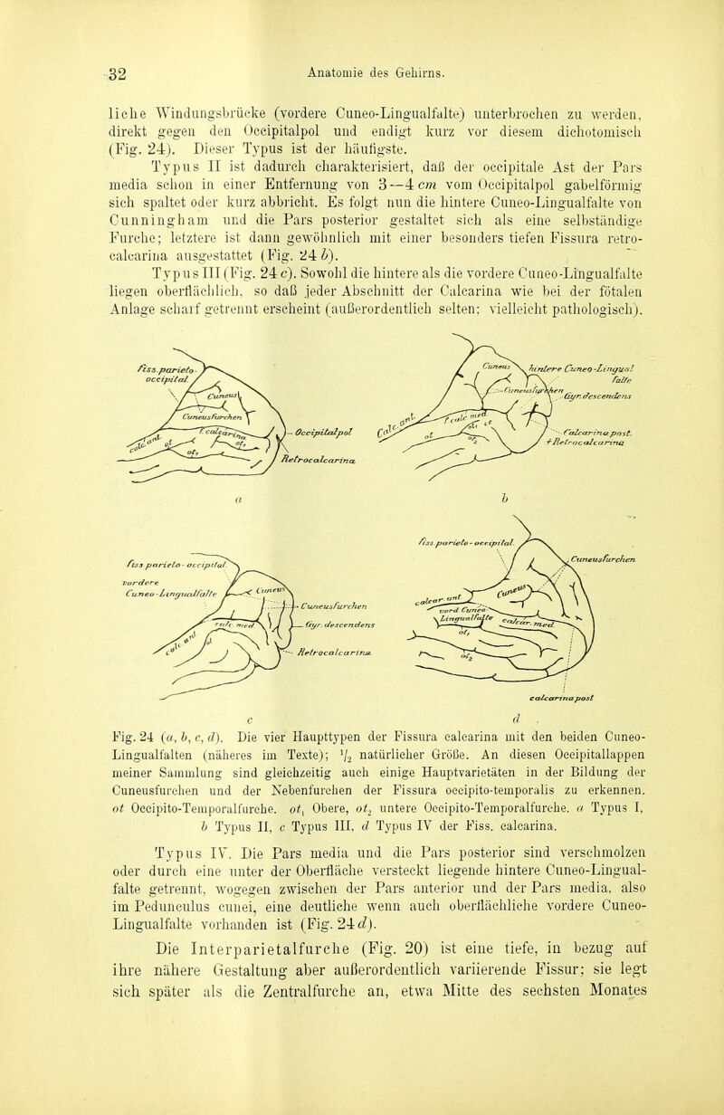 liehe Windungsbrücke (vordere Cuneo-Lingualfalte) iinterbroclieii zu werden, direkt gegen den Oceipitalpol und endigt kurz vor diesem dichotouiiscli (Fig. 24). Dieser Typus ist der häutigste. Typus II ist dadurch charakterisiert, daß der occipitale Ast der Pars media schon in einer Entfernung von 3—4 cm vom Oceipitalpol gabelförmig sieh spaltet oder kurz abbiicht. Es folgt nun die hintere Cuneo-Lingualfalte von Cunningham und die Pars posterior gestaltet sieh als eine selbständige Furche; letztere ist dann gewölinlieh mit einer besonders tiefen Fissura retro- calearina ausgestattet (Fig. 24 Z*). Typus III (Fig. 24 c). Sowohl die hintere als die vordere Cuueo-Lingualfalte liegen oberfiäclilich, so daß jeder Abschnitt der Calearina wie bei der fötalen Anlage scharf getrennt erscheint (außerordentlich selten: vielleicht pathologisch). Fig. 24 («, h, c, d). Die vier Haupttypen der Fissura calearina mit den beiden Cuneo- Lingualfalten (nälieres im Texte); '/a natürlielier Größe. An diesen Oceipitallappen meiner Sammking sind gleichzeitig auch einige Hauptvarietäten in der Bildung der Cuneusfurchen und der Nebenfurclien der Fissura oceipito-temporalis zu erkennen. ot Oceipito-Temporalfurehe. ot^ Obere, ot^ untere Occipito-Temporalfurehe. a Typus I, h Typus II, c Typus HI, d Typus IV der Fiss. calearina. Typus IV'. Die Pars media und die Pars posterior sind verschmolzen oder durch eine unter der Oberfläche versteckt liegende hintere Cuneo-Lingual- falte getrennt, wogegen zwischen der Pars anterior und der Pars media, also im Pedunculus eunei, eine deutliehe wenn auch oberflächliche vordere Cuneo- Lingualfalte vorhanden ist (Fig. 24c?j. Die Interparietalfurche (Fig. 20) ist eine tiefe, in bezug auf ihre nähere Gestaltung aber außerordentlich variierende Fissur; sie legt sich später als die Zentralfurche an, etwa Mitte des sechsten Monates