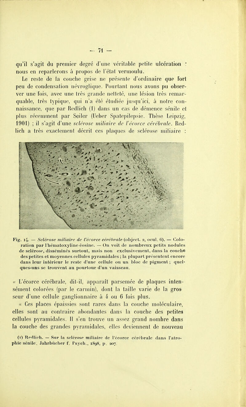 qu'il s'agit du premier degré d'une véritable petile ulcération : nous en reparlerons à propos de l'étal vermoulu. Le reste de la couche grise ne présenle d'ordinaire que fort peu de condensation névroglique. Pourlant nous avons pu obser- ver une fois, avec une très grande netteté, une lésion très remar- quable, très typique, qui n'a été étudiée jusqu'ici, à notre con- naissance, que par Redlich (1) dans un cas de démence sénile et plus récemment par Seiler (Ueber Spatepilepsie. Thèse Leipzig, 1901) ; il s'agit d'une sclérose miliaire de récorce cérébrale. Red- lich a très exaclement décrit ces plaques de sclérose miliaire : Fig. 14. — Sclérose miliaire de l'écorce cérébrale (object. 2, ocul. 6). — Colo- ration par l'hématoxyline-éosine. — On voit de nombreux petits nodules de sclérose, disséminés surtout, mais non exclusivement, dans la couche des petites et moyennes cellules pyramidales ; la i)lupart présentent encore dans leur intérieur le reste d'une cellule ou un bloc de pigment ; quel- ques-uns se trouvent au pourtour d'un vaisseau. « L'écorce cérébrale, dit-il, apparaît parsemée de plaques inten- sément colorées (par le carmin), dont la taille varie de la gros- seur d'une cellule ganglionnaire à 4 ou 6 fois plus. « Ces places épaissies sont rares dans la couche moléculaire, elles sont au contraire abondantes dans la couche des petites cellules pyramidales. 11 s'en trouve un assez grand nombre dans la couche des grandes pyramidales, elles deviennent de nouveau (i) Redlich. — Sur la sclérose miliaire de l'écorce cérébrale dans l'atro- phie sénile. Jahrbiicher f. Psych., 1898, p. 207.