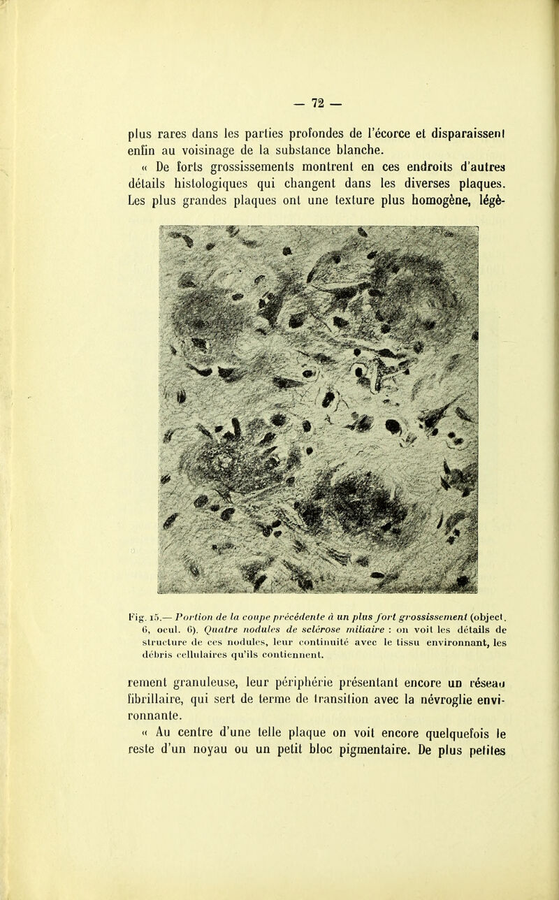 plus rares dans les parties profondes de l'écorce et disparaisseni enfin au voisinage de la substance blanche. « De forts grossissements montrent en ces endroits d'autres détails histologiques qui changent dans les diverses plaques. Les plus grandes plaques ont une texture plus homogène, légè- Fig. i5.— Portion de la coupe précédente à un plus fort grossissement (objecl. 6, ocul. 6). Quatre nodules de sclérose rniliaire : on voit les détails de structure de ces nodules, leur continuité avec le tissu environnant, les débris cellulaires qu'ils contiennent. rement granuleuse, leur périphérie présentant encore un réseau îibrillaire, qui sert de terme de transition avec la névroglie envi- ronnante. « Au centre d'une telle plaque on voit encore quelquefois le reste d'un noyau ou un petit bloc pigmentaire. De plus petites