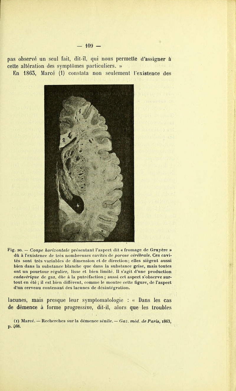 pas observé un seul fait, dit-il, qui nous permette d'assigner à cette altération des symptômes particuliers. » En 1863, Marcé (1) constata non seulement l'existence des Fig. 20. — Coupe horizontale présentant l'aspect dit « fromage de Gruyère » dû à l'existence de très nombreuses cavités de porose cérébrale. Ces cavi- tés sont très variables de dimension et de direction; elles siègent aussi bien dans la substance blanche que dans la substance grise, mais toutes ont un pourtour régulier, lisse et bien limité. Il s'agit d'iine production cadavérique de gaz, due à la putréfaction ; aussi cet aspect s'observe sur- tout en été ; il est bien différent, comme le montre cette figure, de l'aspect d'un cerveau contenant des lacunes de désintégration. lacunes, mais presque leur symptomatologie : « Dans les cas de démence à forme progressive, dit-il, alors que les troubles (i) Marcé. — Recherches sur la démence sénile. — Gaz. méd. de Paris, i863, p. 468.