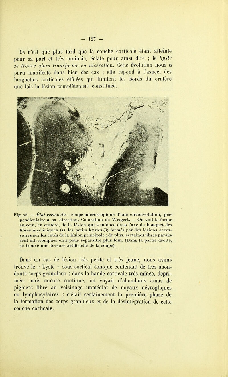 Ce n'est que plus tard que la couche corticale étant atteinte pour sa part et très amincie, éclate pour ainsi dire ; le kysle se trouve alors translormé en ulcération. Cette évolution nous a paru manifeste dans bien des cas ; elle répond à l'aspect des languettes corticales effilées qui limitent les bords du cratère une fois la lésion complètement constituée. Fig. 25. — État vermoulu : coupe microscopique d'une circonvolution, per- pendiculaire à sa direction. Coloration de Weigert. — On voit la forme en coin, en cratère, de la lésion qui s'enfonce dans l'axe du bouquet des fibres myéliniques (i), les petits kystes (3) formés par des lésions acces- soires sur les côtés de la lésion principale ; de plus, certaines libres parais- sent interrompues en 2 pour repai'aître plus loin. (Dans la partie droite, se trouve une brisure artificielle de la coupe). Dans un cas de lésion très petite et très jeune, nous avons trouvé le « kyste » sous-cortical conique contenant de très abon- dants corps granuleux ; dans la bande corticale très mince, dépri- mée, mais encore continue, on voyait d'abondants amas de pigment libre au voisinage immédiat de noyaux névrogliques ou lymphocytaires : c'était certainement la première phase de la formation des corps granuleux et de la désintégration de cette couche corticale.