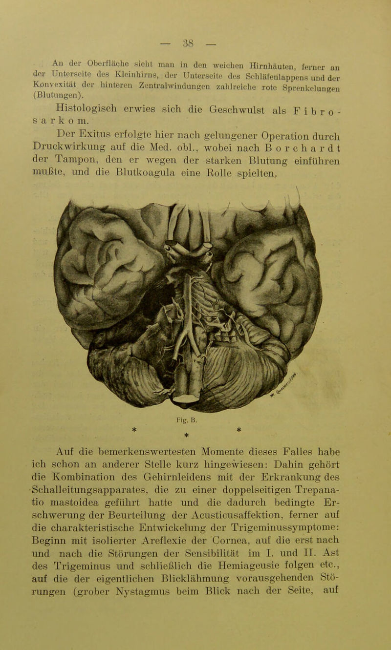 An der Oberfläche siebt man in den weiciien Hirnliüuten, ferner an der Unterseite dos Kleinhirns, der Unterseite des Sehlüfenlappens und der Konvexität der hinteren Zentrahvindun.[<cn zahlreiche rote SprenkeluiiRen (Blutungen). Histologisch erwies sich die Geschwulst als F i b r o - Sarkom. Der Exitus erfolgte hier nach gehuigener Operation durch Druckwirkung auf die Med. obl., wobei nach B o r c h a r d t der Tampon, den er wegen der starken Blutung einführen mußte, und die Blutkoagula eine Rolle spielten. Fig. B. * * Auf die bemerkenswertesten Momente dieses Falles habe ich schon an anderer Stelle kurz hingewiesen: Dahin gehört die Kombination des Gehirnleidens mit der Erkrankimg des Schalleitungsapparates, die zu einer doppelseitigen Trepana- tio mastoidea geführt hatte und die dadurch bedingte Er- schwerung der Beurteilung der Acusticusaffektion, ferner auf die charakteristische Entwickelung der Trigeminussymptome: Beginn mit isolierter Areflexie der Cornea, auf die erst nach und nach die Störungen der Sensibilität im I. vmd II. Ast des Trigeminus und schließlieh die Hemiageusie folgen etc., auf die der eigentlichen Blickhähmung vorausgehenden Stö- rungen (grober Nystagmus beim Blick nach der Seite, auf