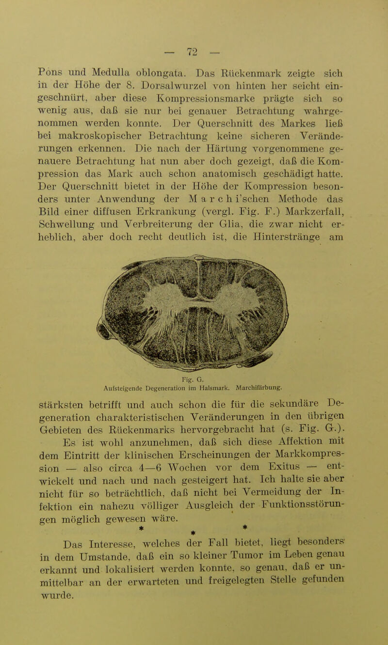 Pons und Medulla oblongata. Das Rückenmark zeigte sich in der Höhe der 8. Dorsalwurzel von hinten her seicht ein- geschnürt, aber diese Kompressionsmarke prägte sich so wenig aus, daß sie nur bei genauer Betrachtung wahrge- nommen werden konnte. Der Querschnitt des Markes ließ bei makroskopischer Betrachtung keine sicheren Verände- rungen erkennen. Die nach der Härtung vorgenommene ge- nauere Betrachtung hat nun aber doch gezeigt, daß die Kom- pression das Mark auch schon anatomisch geschädigt hatte. Der Querschnitt bietet in der Höhe der Kompression beson- ders unter Anwendung der March i'schen Methode das Bild einer diffusen Erkrankung (vergl. Fig. F.) Markzerfall, Schwellung und Verbreiterung der Glia, die zwar nicht er- heblich, aber doch recht deutlich ist, die Hinterstränge am Fig. G. Aufsteigende Degeneration im Halsmarl<. Marchirärbung. stärksten betrifft und auch schon die für die sekundäre De- generation charakteristischen Veränderungen in den übrigen Gebieten des Rückenmarks hervorgebracht hat (s. Fig. G.). Es ist wohl anzunehmen, daß sich diese Affektion mit dem Eintritt der klinischen Erscheinungen der Markkompres- sion — also circa 4—6 Wochen vor dem Exitus — ent- wickelt und nach und nach gesteigert hat. Ich halte sie aber nicht für so beträchtlich, daß nicht bei Vermeidung der In- fektion ein nahezu völliger Ausgleich der Funktionsstörun- gen möglich gewesen wäre. ♦ * Das Interesse, welches der Fall bietet, liegt besonders in dem Umstände, daß ein so kleiner Tumor im Leben genau erkannt und lokalisiert werden konnte, so genau, daß er un- mittelbar an der erwarteten und freigelegten Stelle gefunden wurde.