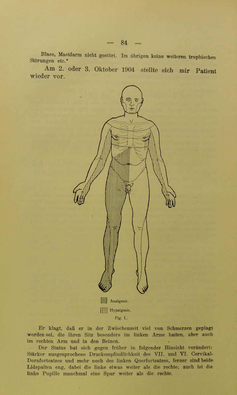 Blase, Mastdarm nicht gestört. Im übrigen keine weiteren trophischen Störungen etc. Am 2. oder 3. Oktober 1904 stellte sich mir Patient wieder vor. Ell Analgesie. Hill Hypalgcsic. Fig. L. Er klagt, daß er in der Zwischenzeit viel von Schmerzen geplagt worden sei, die ihren Sitz besonders im linken Arme hatten, aber auch im rechten Arm und in den Beinen. Der Status hat sich gegen früher in folgender Hinsicht verändert: Stärker ausgesprochene Druckempfindlichkeit des VII. und VI. Cervikal- Dornfortsatzes und mehr noch des linken Querfovtsatzes, ferner sind beide Lidspalten eng, dabei die linke etwas weiter als die rechte; auch ist die linke Pupille manchmal eine Spur weiter als die rechte.