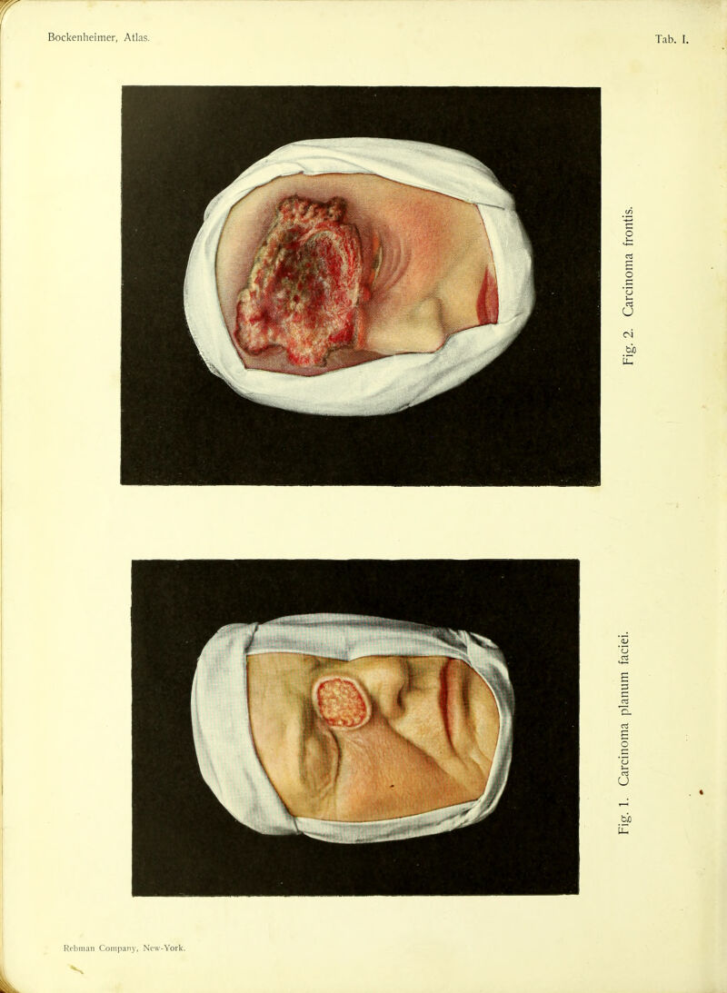 Bockenheimer, Atlas. Tab. I.