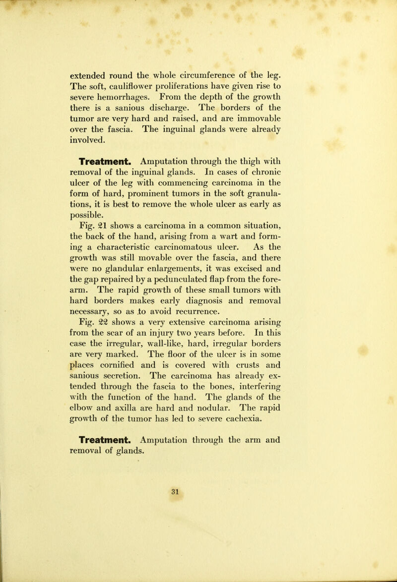 extended round the whole circumference of the leg. The soft, cauliflower proliferations have given rise to severe hemorrhages. From the depth of the growth there is a sanious discharge. The borders of the tumor are very hard and raised, and are immovable over the fascia. The inguinal glands were already involved. Treatment. Amputation through the thigh with removal of the inguinal glands. In cases of chronic ulcer of the leg with commencing carcinoma in the form of hard, prominent tumors in the soft granula- tions, it is best to remove the whole ulcer as early as possible. Fig. 21 shows a carcinoma in a common situation, the back of the hand, arising from a wart and form- ing a characteristic carcinomatous ulcer. As the growth was still movable over the fascia, and there were no glandular enlargements, it was excised and the gap repaired by a pedunculated flap from the fore- arm. The rapid growth of these small tumors with hard borders makes early diagnosis and removal necessary, so as .to avoid recurrence. Fig. 22 shows a very extensive carcinoma arising from the scar of an injury two years before. In this case the irregular, wall-like, hard, irregular borders are very marked. The floor of the ulcer is in some places cornified and is covered with crusts and sanious secretion. The carcinoma has already ex- tended through the fascia to the bones, interfering with the function of the hand. The glands of the elbow and axilla are hard and nodular. The rapid growth of the tumor has led to severe cachexia. Treatment. Amputation through the arm and removal of glands. 31