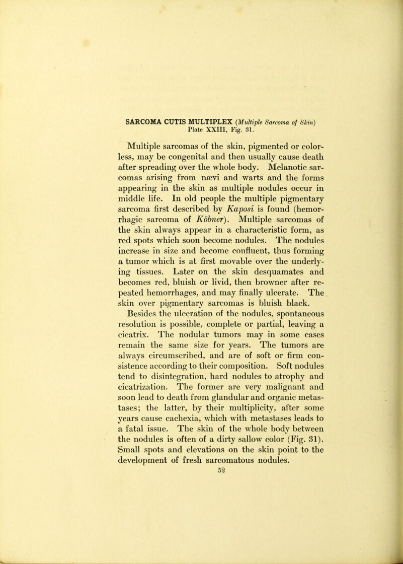 SARCOMA CUTIS MULTIPLEX (Multiple Sarcoma of Skin) Plate XXIII, Fig. 31. Multiple sarcomas of the skin, pigmented or color- less, may be congenital and then usually cause death after spreading over the whole body. Melanotic sar- comas arising from nsevi and warts and the forms appearing in the skin as multiple nodules occur in middle life. In old people the multiple pigmentary sarcoma first described by Kaposi is found (hemor- rhagic sarcoma of Kohner). Multiple sarcomas of the skin always appear in a characteristic form, as red spots which soon become nodules. The nodules increase in size and become confluent, thus forming a tumor which is at first movable over the underly- ing tissues. Later on the skin desquamates and becomes red, bluish or livid, then browner after re- peated hemorrhages, and may finally ulcerate. The skin over pigmentary sarcomas is bluish black. Besides the ulceration of the nodules, spontaneous resolution is possible, complete or partial, leaving a cicatrix. The nodular tumors may in some cases remain the same size for years. The tumors are always circumscribed, and are of soft or firm con- sistence according to their composition. Soft nodules tend to disintegration, hard nodules to atrophy and cicatrization. The former are very malignant and soon lead to death from glandular and organic metas- tases; the latter, by their multiplicity, after some years cause cachexia, which with metastases leads to a fatal issue. The skin of the whole body between the nodules is often of a dirty sallow color (Fig. 31). Small spots and elevations on the skin point to the development of fresh sarcomatous nodules.