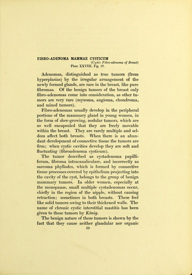 FIBRO-ADENOMA MAMMAE CYSTICUM (Cystic Fibro-adenoma of Breast) Plate XXVIII, Fig. 37. Adenomas, distinguished as true tumors (from hyperplasias) by the irregular arrangement of the newly formed glands, are rare in the breast, like pure fibromas. Of the benign tumors of the breast only fibro-adenomas come into consideration, as other tu- mors are very rare (myxoma, angioma, chondroma, and mixed tumors). Fibro-adenomas usually develop in the peripheral portions of the mammary gland in young women, in the form of slow-growing, nodular tumors, which are so well encapsuled that they are freely movable within the breast. They are rarely multiple and sel- dom affect both breasts. When there is an abun- dant development of connective tissue the tumors are firm; when cystic cavities develop they are soft and fluctuating (fibroadenoma cysticum). The tumor described as cystadenoma papilli- ferum, fibroma intracanaliculare, and incorrectly as sarcoma phyllodes, which is formed by connective tissue processes covered by epithelium projecting into the cavity of the cyst, belongs to the group of benign mammary tumors. In older women, especially at the menopause, small multiple cystadenomas occur, chiefly in the region of the nipple, without causing retraction; sometimes in both breasts. These feel like solid tumors owing to their thickened walls. The name of chronic cystic interstitial mastitis has been given to these tumors by Konig. The benign nature of these tumors is shown by the fact that they cause neither glandular nor organic
