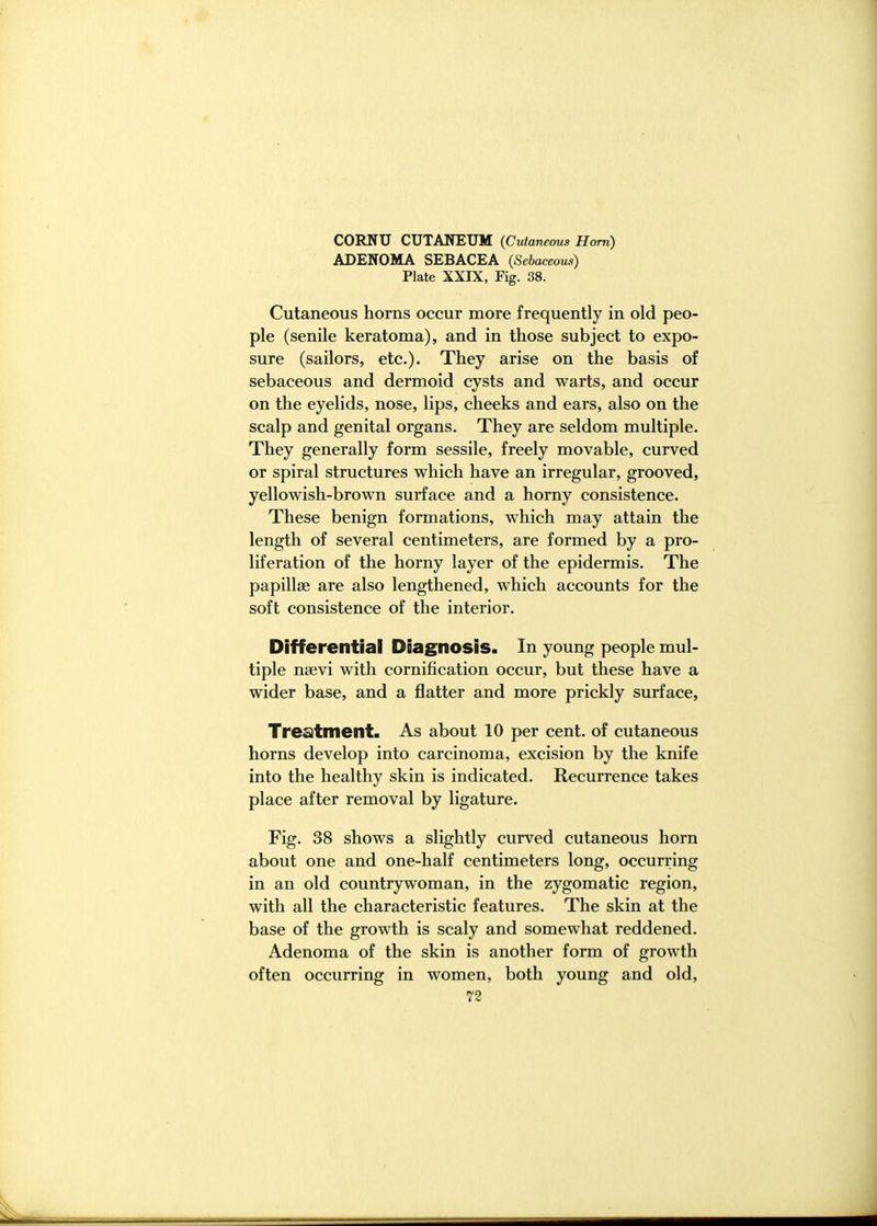 CORNU CUTAWEUM (Cutaneous Ham) ADENOMA SEBACEA (Sebaceous) Plate XXrX, Fig. 38. Cutaneous horns occur more frequently in old peo- ple (senile keratoma), and in those subject to expo- sure (sailors, etc.). They arise on the basis of sebaceous and dermoid cysts and warts, and occur on the eyelids, nose, lips, cheeks and ears, also on the scalp and genital organs. They are seldom multiple. They generally form sessile, freely movable, curved or spiral structures which have an irregular, grooved, yellowish-brown surface and a horny consistence. These benign formations, which may attain the length of several centimeters, are formed by a pro- liferation of the horny layer of the epidermis. The papillae are also lengthened, which accounts for the soft consistence of the interior. Differential Diagnosis. In young people mul- tiple nsevi with cornification occur, but these have a wider base, and a flatter and more prickly surface, Treatment. As about 10 per cent, of cutaneous horns develop into carcinoma, excision by the knife into the healthy skin is indicated. Recurrence takes place after removal by ligature. Fig. 38 shows a slightly curved cutaneous horn about one and one-half centimeters long, occurring in an old countrywoman, in the zygomatic region, with all the characteristic features. The skin at the base of the growth is scaly and somewhat reddened. Adenoma of the skin is another form of growth often occurring in women, both young and old,