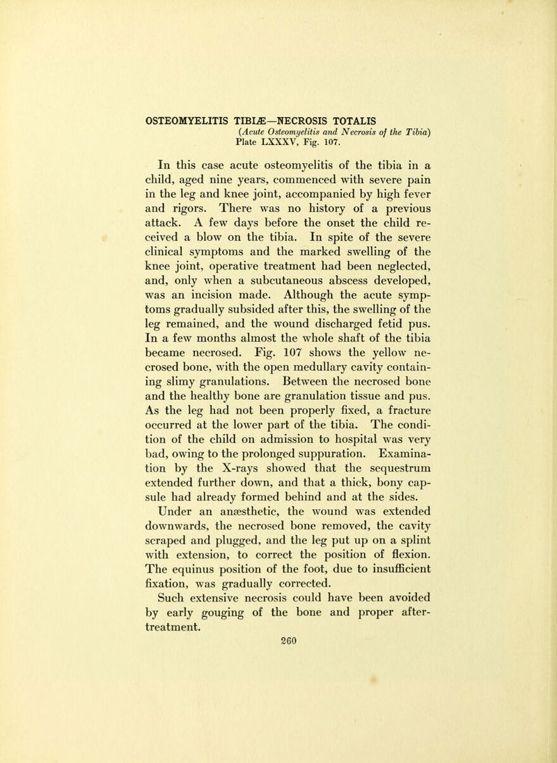 OSTEOMYELITIS TIBUE—NECROSIS TOTALIS {Acute Osteomyelitis and Necrosis of the Tibia) Plate LXXXV, Fig. 107. In this case acute osteomyelitis of the tibia in a child, aged nine years, commenced with severe pain in the leg and knee joint, accompanied by high fever and rigors. There was no history of a previous attack. A few days before the onset the child re- ceived a blow on the tibia. In spite of the severe clinical symptoms and the marked swelling of the knee joint, operative treatment had been neglected, and, only when a subcutaneous abscess developed, was an incision made. Although the acute symp- toms gradually subsided after this, the swelling of the leg remained, and the wound discharged fetid pus. In a few months almost the whole shaft of the tibia became necrosed. Fig. 107 shows the yellow ne- crosed bone, with the open medullary cavity contain- ing slimy granulations. Between the necrosed bone and the healthy bone are granulation tissue and pus. As the leg had not been properly fixed, a fracture occurred at the lower part of the tibia. The condi- tion of the child on admission to hospital was very bad, owing to the prolonged suppuration. Examina- tion by the X-rays showed that the sequestrum extended further down, and that a thick, bony cap- sule had already formed behind and at the sides. Under an anaesthetic, the wound was extended downwards, the necrosed bone removed, the cavity scraped and plugged, and the leg put up on a splint with extension, to correct the position of flexion. The equinus position of the foot, due to insufficient fixation, was gradually corrected. Such extensive necrosis could have been avoided by early gouging of the bone and proper after- treatment. 260