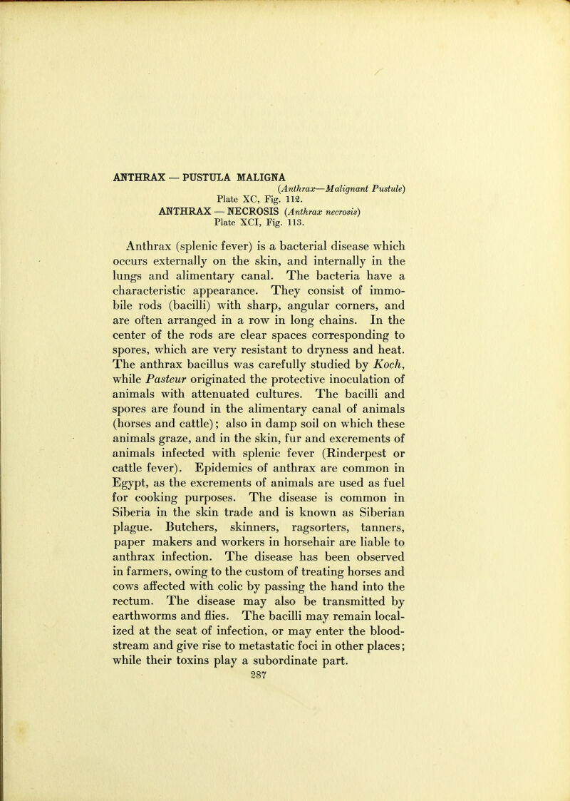 ANTHRAX — PUSTULA MALIGNA {Anthrax—Malignant Pustule) Plate XC, Fig. 112. ANTHRAX — NECROSIS (Anthrax necrosis) Plate XCI, Fig. 113. Anthrax (splenic fever) is a bacterial disease which occurs externally on the skin, and internally in the lungs and alimentary canal. The bacteria have a characteristic appearance. They consist of immo- bile rods (bacilli) with sharp, angular corners, and are often arranged in a row in long chains. In the center of the rods are clear spaces corresponding to spores, which are very resistant to dryness and heat. The anthrax bacillus was carefully studied by Koch, while Pasteur originated the protective inoculation of animals with attenuated cultures. The bacilli and spores are found in the alimentary canal of animals (horses and cattle); also in damp soil on which these animals graze, and in the skin, fur and excrements of animals infected with splenic fever (Rinderpest or cattle fever). Epidemics of anthrax are common in Egypt, as the excrements of animals are used as fuel for cooking purposes. The disease is common in Siberia in the skin trade and is known as Siberian plague. Butchers, skinners, ragsorters, tanners, paper makers and workers in horsehair are liable to anthrax infection. The disease has been observed in farmers, owing to the custom of treating horses and cows affected with colic by passing the hand into the rectum. The disease may also be transmitted by earthworms and iBies. The bacilli may remain local- ized at the seat of infection, or may enter the blood- stream and give rise to metastatic foci in other places; while their toxins play a subordinate part.