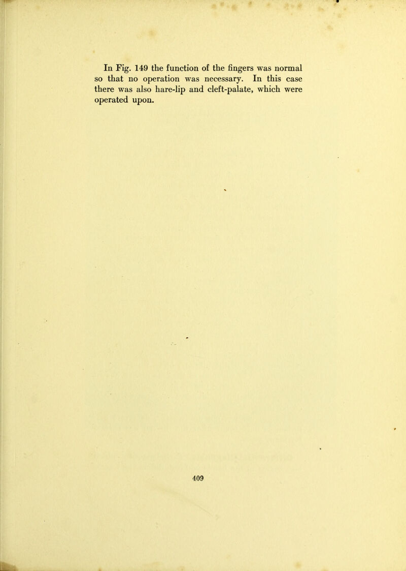 In Fig. 149 the function of the fingers was normal so that no operation was necessary. In this case there was also hare-lip and cleft-palate, which were operated upon.