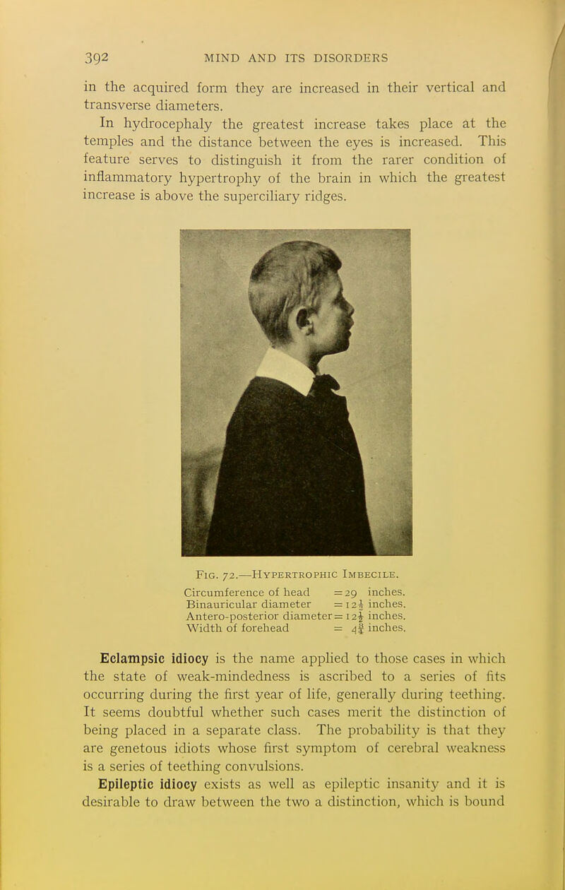 in the acquired form they are increased in their vertical and transverse diameters. In hydrocephaly the greatest increase takes place at the temples and the distance between the eyes is increased. This feature sei'ves to distinguish it from the rarer condition of inflammatory hypertrophy of the brain in which the greatest increase is above the superciliary ridges. Fig. 72.—Hypertrophic Imbecile. Circumference of head = 29 inches. Binauricular diameter =12^ inches. Antero-posterior diameter = 12J inches. Width of forehead = ^1 inches. Eclampsic idiocy is the name applied to those cases in which the state of weak-mindedness is ascribed to a series of fits occurring during the first year of life, generally during teething. It seems doubtful whether such cases merit the distinction of being placed in a separate class. The probability is that they are genetous idiots whose first symptom of cerebral weakness is a series of teething convulsions. Epileptic idiocy exists as well as epileptic insanity and it is desirable to draw between the two a distinction, which is bound