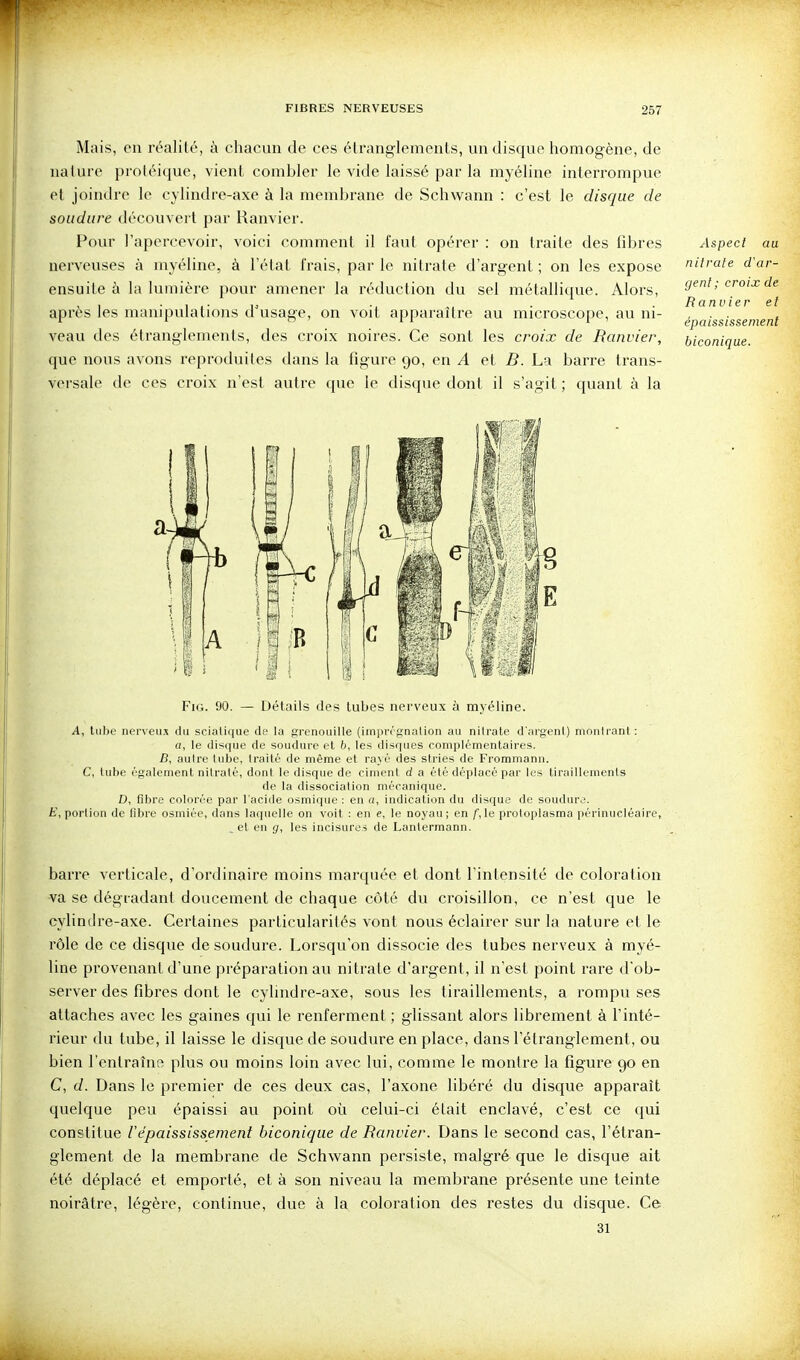 Mais, on réalité, à chacun de ces étranglements, un disque homogène, de nature proléique, vient combler le vide laissé par la myéline interrompue et joindre le cylindre-axe à la membrane de Schwann : c'est le disque de soudure découvert par Ranvier. Pour l'apercevoir, voici comment il faut opérer : on traite des fibres nerveuses à myéline, à l'état frais, par le nitrate d'argent ; on les expose ensuite à la lumière pour amener la réduction du sel métallique. Alors, après les manipulations d'usage, on voit apparaître au microscope, au ni- veau des étranglements, des croix noires. Ce sont les croix de Ranvier, que nous avons reproduites dans la figure 90, en A et B. La barre trans- versale de ces croix n'est autre que le disque dont il s'agit ; quant à la Aspect au niirale d'ar- gent; croix de Ranvier et épaississenient biconique. FiG. 90. — Détails des lubes nerveux à myéline. A, tiibt' nerveii.^ du sciaU(|ue de la grenouille (iini)rr;in;ilion au nitrate d'argeni) montrant : a, le disi|ue de soudure et b, les dis(|ues complémentaires. B, autre tul)e, traité de même et rayé des stries de Frommann. C, tube également nitrate, dont le disque de ciment d a été déplacé par les tiraillements de la dissociation mécanique. D, fibre colorée par l'acide osniique : en n, indication du disque de souchuv. , portion de fibre osmiée, dans laquelle on voit : en e, ]i: noyau; en /',1e proloplasma périnucléaire, . et en g, les incisures de Lanterraann. barre verticale, d'ordinaire moins marquée et dont l'intensité de coloration va se dégradant doucement de chaque côté du croisillon, ce n'est que le cylindre-axe. Certaines particularités vont nous éclairer sur la nature et le rôle de ce disque de soudure. Lorsqu'on dissocie des tubes nerveux à myé- line provenant d'une préparation au nitrate d'argent, il n'est point rare d'ob- server des fibres dont le cylindre-axe, sous les tiraillements, a rompu ses attaches avec les gaines qui le renferment ; glissant alors librement à l'inté- rieur du tube, il laisse le disque de soudure en place, dans l'étranglement, ou bien l'entraîne plus ou moins loin avec lui, comme le montre la figure 90 en C, d. Dans le premier de ces deux cas, l'axone libéré du disque apparaît quelque peu épaissi au point où celui-ci était enclavé, c'est ce qui constitue l'épaississement biconique de Ranvier. Dans le second cas, l'étran- glement de la membrane de Schwann persiste, malgré que le disque ait été déplacé et emporté, et à son niveau la membrane présente une teinte noirâtre, légère, continue, due à la coloration des restes du disque. Ce: 31