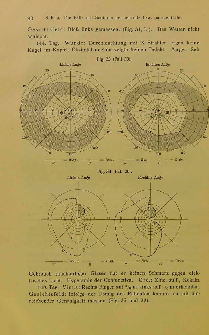 Gesichtsfeld: Bloß links gemessen. (Fig. 31, L.). Das Wetter nicht schlecht. 144. Tag. Wunde: Durchleuchtung mit X-Strahlen ergab keine Kugel im Kopfe, Okzipitalknochen zeigte keinen Defekt. Auge: Seit Fig. 32 (Fall 20). Linkes Aii§e Bechtes Aii^e = Weiß, = Blau, = Rot, ■ = Grün. B R G Gebrauch rauchfarbiger Gläser hat er keinen Schmerz gegen elek- trisches Licht. Hyperämie der Conjunctiva. Ord.: Zinc. sulf., Kokain. 149. Tag. Visus: Rechts Finger auf Ve m, links auf Ve ^ erkennbar. Gesichtsfeld: Infolge der Übung des Patienten konnte ich mit hin- reichender Genauigkeit messen (Fig. 32 und 33).