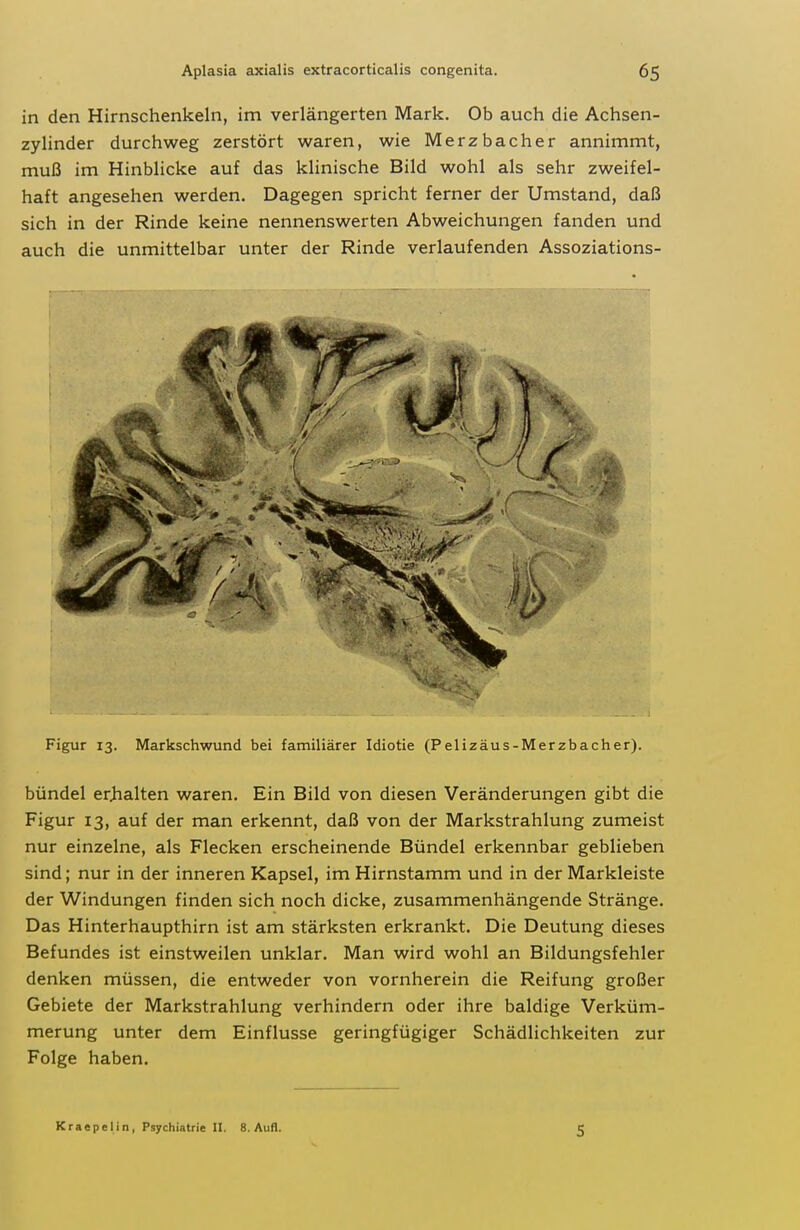 in den Hirnschenkeln, im verlängerten Mark. Ob auch die Achsen- zylinder durchweg zerstört waren, wie Merzbacher annimmt, muß im Hinblicke auf das klinische Bild wohl als sehr zweifel- haft angesehen werden. Dagegen spricht ferner der Umstand, daß sich in der Rinde keine nennenswerten Abweichungen fanden und auch die unmittelbar unter der Rinde verlaufenden Assoziations- Figur 13. Markschwund bei familiärer Idiotie (Pelizäus-Merzbacher). bündel er>ialten waren. Ein Bild von diesen Veränderungen gibt die Figur 13, auf der man erkennt, daß von der Markstrahlung zumeist nur einzelne, als Flecken erscheinende Bündel erkennbar geblieben sind; nur in der inneren Kapsel, im Hirnstamm und in der Markleiste der Windungen finden sich noch dicke, zusammenhängende Stränge. Das Hinterhaupthirn ist am stärksten erkrankt. Die Deutung dieses Befundes ist einstweilen unklar. Man wird wohl an Bildungsfehler denken müssen, die entweder von vornherein die Reifung großer Gebiete der Markstrahlung verhindern oder ihre baldige Verküm- merung unter dem Einflüsse geringfügiger Schädlichkeiten zur Folge haben. Kraepclin, Psychiatrie II. 8. Aufl. 5