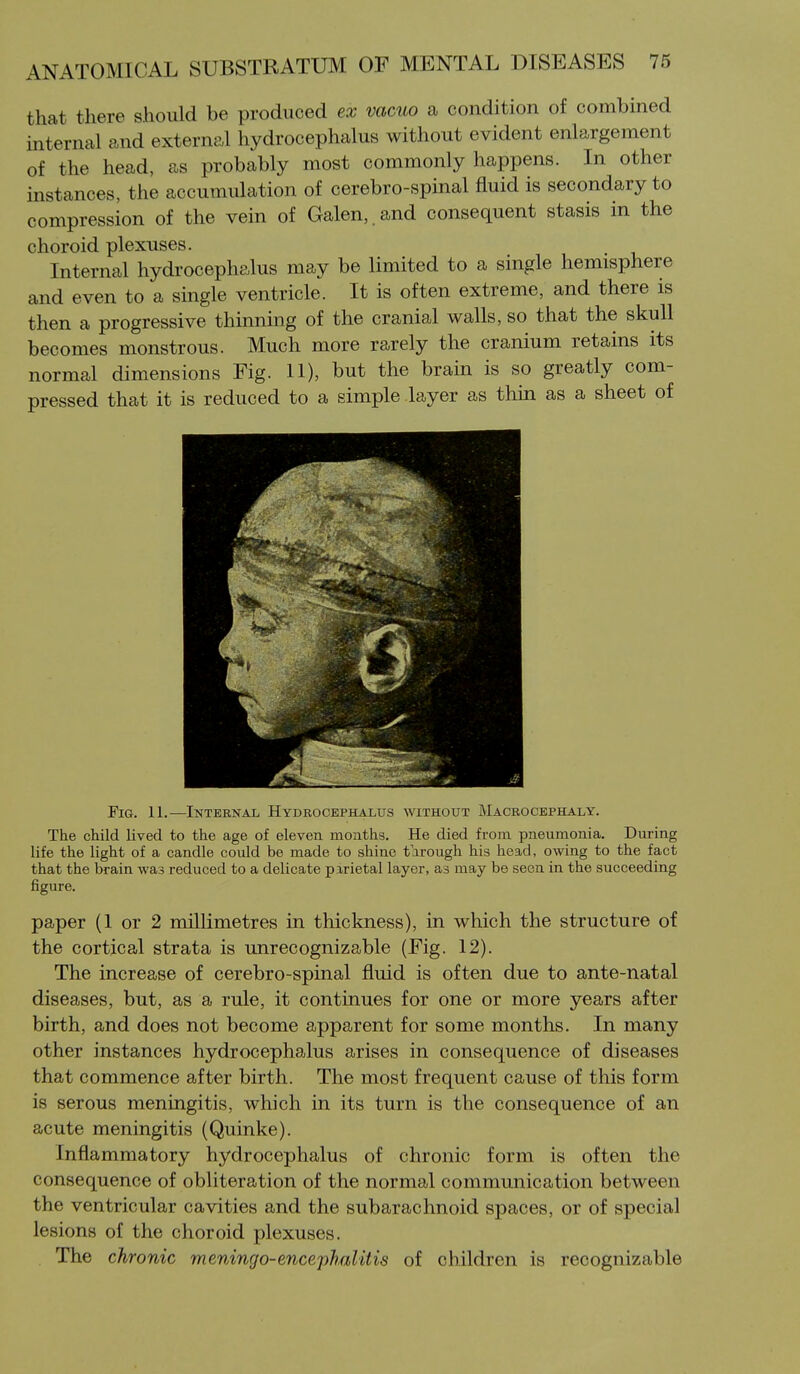 that there should be produced ex vacuo a condition of combined internal and external hydrocephalus without evident enlargement of the head, as probably most commonly happens. In other instances, the accumulation of cerebro-spinal fluid is secondary to compression of the vein of Galen,.and consequent stasis in the choroid plexuses. Internal hydrocephalus may be limited to a single hemisphere and even to a smgle ventricle. It is often extreme, and there is then a progressive thinning of the cranial walls, so that the skull becomes monstrous. Much more rarely the cranium retains its normal dimensions Fig. 11), but the brain is so greatly com- pressed that it is reduced to a simple layer as thui as a sheet of Fig. 11.—Inteenal Hydrocephalus without Macrocephaly. The child lived to the age of eleven months. He died from pneumonia. During life the light of a candle could be made to shine tarough his head, owing to the fact that the brain was reduced to a delicate parietal layer, as may be seen in the succeeding figure. paper (1 or 2 millimetres in thickness), in which the structure of the cortical strata is unrecognizable (Fig. 12). The increase of cerebro-spinal fluid is often due to ante-natal diseases, but, as a rule, it continues for one or more years after birth, and does not become apparent for some months. In many other instances hydrocephalus arises in consequence of diseases that commence after birth. The most frequent cause of this form is serous meningitis, which in its turn is the consequence of an acute meningitis (Quinke). Inflammatory hydrocephalus of chronic form is often the consequence of obliteration of the normal communication between the ventricular cavities and the subarachnoid spaces, or of special lesions of the choroid plexuses. The chronic meningo-encephalitis of children is recognizable