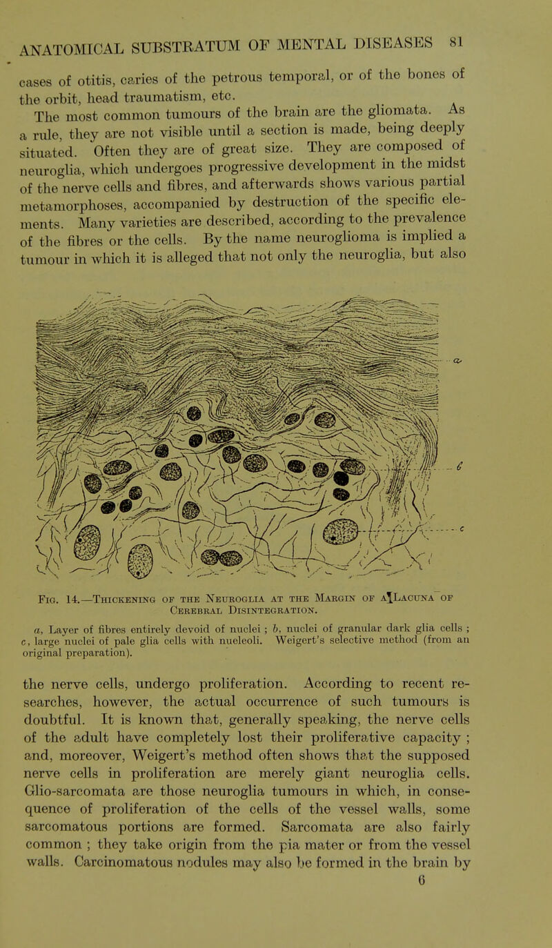 cases of otitis, caries of the petrous temporal, or of the bones of the orbit, head traumatism, etc. The most common tumours of the brain are the gliomata. As a rule, they are not visible until a section is made, being deeply situated. Often they are of great size. They are composed of neuroglia, which undergoes progressive development in the midst of the nerve cells and fibres, and afterwards shows various partial metamorphoses, accompanied by destruction of the specific ele- ments. Many varieties are described, according to the prevalence of the fibres or the cells. By the name neurogUoma is implied a tumour in which it is alleged that not only the neuroglia, but also Fig. 14.—Thickening of the Neuroglia at the Margin of aJLacxjna of Cerebral Disintegration. a, Layer of fibres entirely devoid of nuclei ; b, nuclei of granular dark glia cells ; c, large nuclei of pale glia cells with nueleoli. Weigert's selective method (from an original preparation). the nerve cells, undergo proliferation. According to recent re- searches, however, the actual occurrence of such tumours is doubtful. It is known that, generally speaking, the nerve cells of the adult have completely lost their proliferative capacity ; and, moreover, Weigert's method often shows that the supposed nerve cells in proliferation are merely giant neuroglia cells. Glio-sarcomata are those neuroglia tumours in which, in conse- quence of proliferation of the cells of the vessel walls, some sarcomatous portions are formed. Sarcomata are also fairly common ; they take origin from the pia mater or from the vessel walls. Carcinomatous nodules may also ).>e formed in the brain by 6