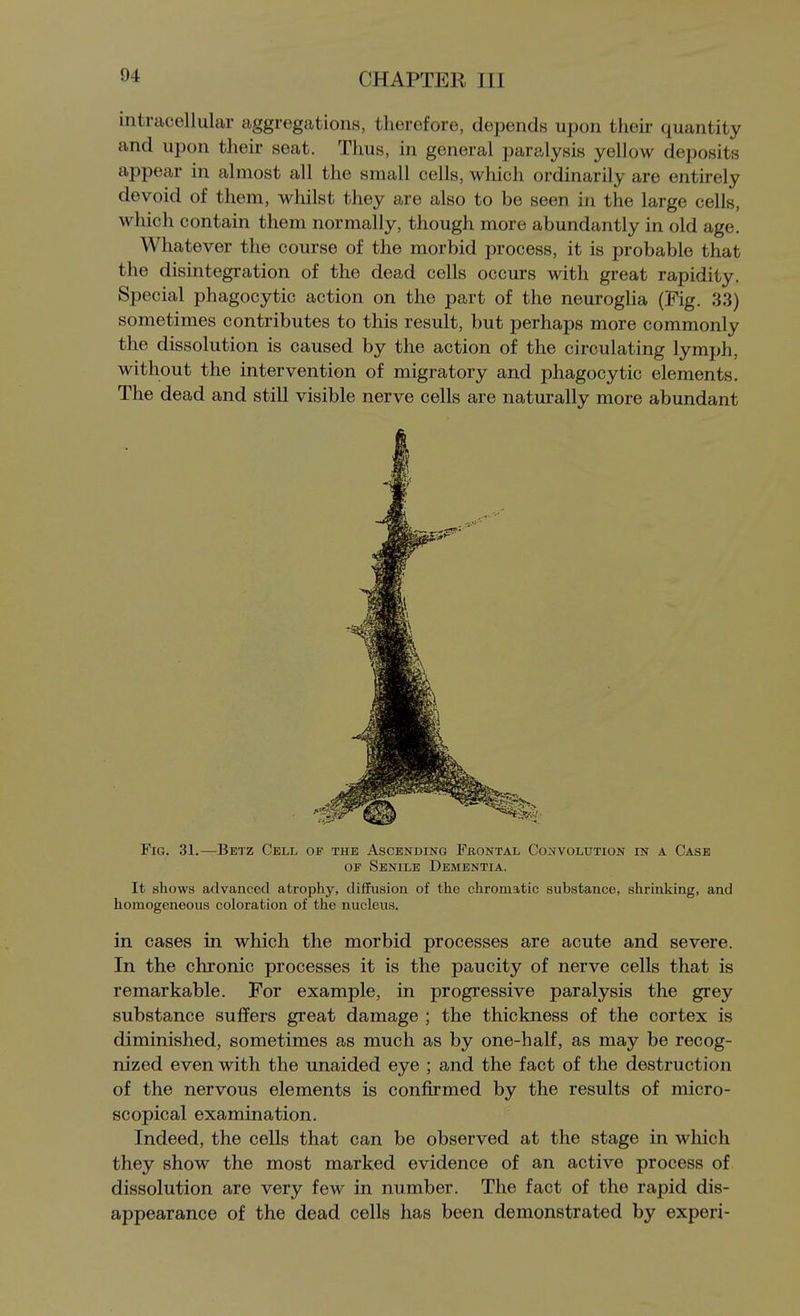 intracellular aggregations, therefore, dependH upon their quantity and upon their seat. Thus, in general paralysis yellow deposits appear in almost all the small cells, which ordinarily are entirely devoid of them, whilst they are also to be seen in the large cells, which contain them normally, though more abundantly in old age. Whatever the course of the morbid process, it is probable that the disintegration of the dead cells occurs with great rapidity. Special phagocytic action on the part of the neuroglia (Fig. 33) sometimes contributes to this result, but perhaps more commonly the dissolution is caused by the action of the circulating lymph, without the intervention of migratory and phagocytic elements. The dead and still visible nerve cells are naturally more abundant Fig. 31.—Betz Cell of the Ascending Frontal Convolution in a Case OF Senile Dementia, It shows advanced atrophy, diffusion of the chromatic substance, shrinking, and homogeneous coloration of the nucleus. in cases in which the morbid processes are acute and severe. In the chronic processes it is the paucity of nerve cells that is remarkable. For example, in progressive paralysis the grey substance suffers great damage ; the thickness of the cortex is diminished, sometimes as much as by one-half, as may be recog- nized even with the unaided eye ; and the fact of the destruction of the nervous elements is confirmed by the results of micro- scopical examination. Indeed, the cells that can be observed at the stage in which they show the most marked evidence of an active process of dissolution are very few in number. The fact of the rapid dis- appearance of the dead cells has been demonstrated by experi-