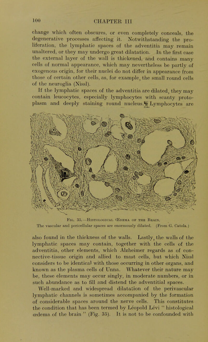 change which often obscures, or even completely conceals, the degenerative processes affecting it. Notwithstanding the pro- liferation, the lymphatic spaces of the adventitia may remain unaltered, or they may undergo great dilatation. In the first case the external layer of the wall is thickened, and contains many cells of normal appearance, which may nevertheless be partly of exogenous origin, for their nuclei do not differ in appearance from those of certain other cells, as, for example, the small round cells of the neuroglia (Nissl). If the lymphatic spaces of the adventitia are dilated, they may contain leucocytes, especially lymphocytes with scanty proto- plasm and deeply staining round nucleus.^ Lymphocytes are Fig. 35.—Histological (Edema op the Brain. The vascular and pericellular spaces are enormously dilated. (From G. Catola.) also found in the thickness of the walls. Lastly, the walls of the lymphatic spaces may contain, together with the cells of the adventitia, other elements, which Alzheimer regards as of con- nective-tissue origin and allied to mast cells, but which Nissl considers to be identical with those occurring in other organs, and known as the plasma cells of Unna. Whatever their nature may be, these elements may occur singly, in moderate numbers, or in such abundance as to fill and distend the adventitial spaces. Well-marked and widespread dilatation of the perivascular lymphatic channels is sometimes accompanied by the formation of considerable spaces around the nerve cells. This constitutes the condition that has been termed by Leopold Levi  histological oedema of the brain  (Fig. 35). It is not to be confounded with