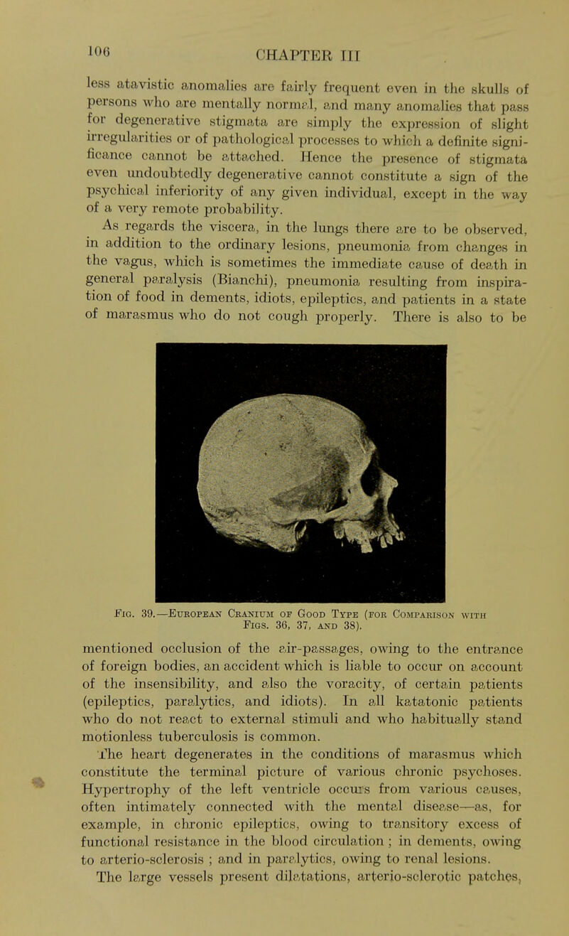 less atavistic anomalies are fairly frequent even in the skulls of persons who are mentally norm?,!, and many anomalies that pass for degenerative stigmata are simply the expression of slight nregularities or of pathological processes to which a definite signi- ficance cannot be attached. Hence the presence of stigmata even undoubtedly degenerative cannot constitute a sign of the psychical inferiority of any given individual, except in the way of a very remote probability. As regards the viscera, in the lungs there are to be observed, in addition to the orduiary lesions, pneumonia from changes in the vagus, which is sometimes the immediate cause of death in general paralysis (Bianchi), pneumonia resulting from inspu-a- tion of food in dements, idiots, epileptics, and patients in a state of marasmus who do not cough properly. There is also to be Fig. 39.—European Cranium of Good Type (for Comparison with Figs. 36, 37, and 38). mentioned occlusion of the air-passages, owing to the entrance of foreign bodies, an accident which is liable to occur on account of the insensibility, and also the voracity, of certain patients (epileptics, paralytics, and idiots). In all katatonic patients who do not react to external stimuli and who habitually stand motionless tuberculosis is common. The heart degenerates in the conditions of marasmus which constitute the terminal picture of various chronic psychoses. Hypertrophy of the left ventricle occurs from various causes, often intimately connected with the mental disease—as, for example, in chronic epileptics, owing to transitory excess of functional resistance in the blood circulation ; in dements, owing to arterio-sclerosis ; and in paralytics, owing to renal lesions. The large vessels present dilatations, arterio-sclerotic patches.
